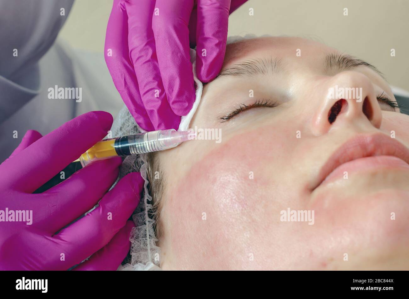 Woman face makes beauty injections around eyes, syringe, medicine ...