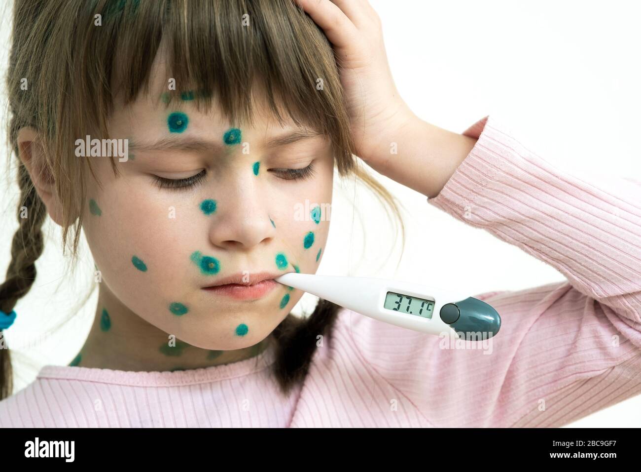 Child girl covered with green rashes on face ill with chickenpox, measles or rubella virus holding medical thermometer in her mouth having high temper Stock Photo