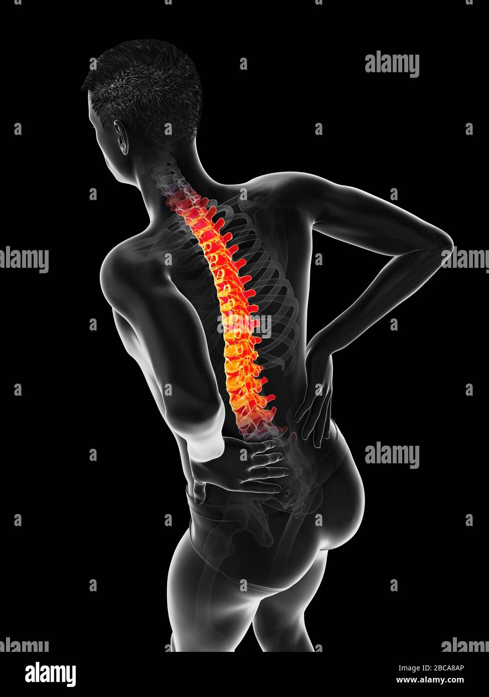 Acute back pain, illustration Stock Photo - Alamy