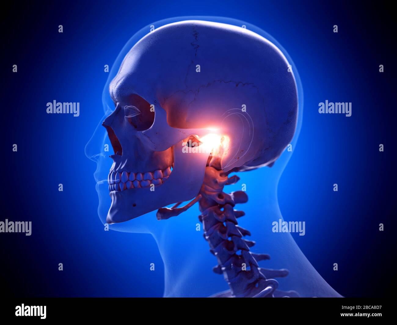 Painful temporomandibular joint, illustration. Stock Photo