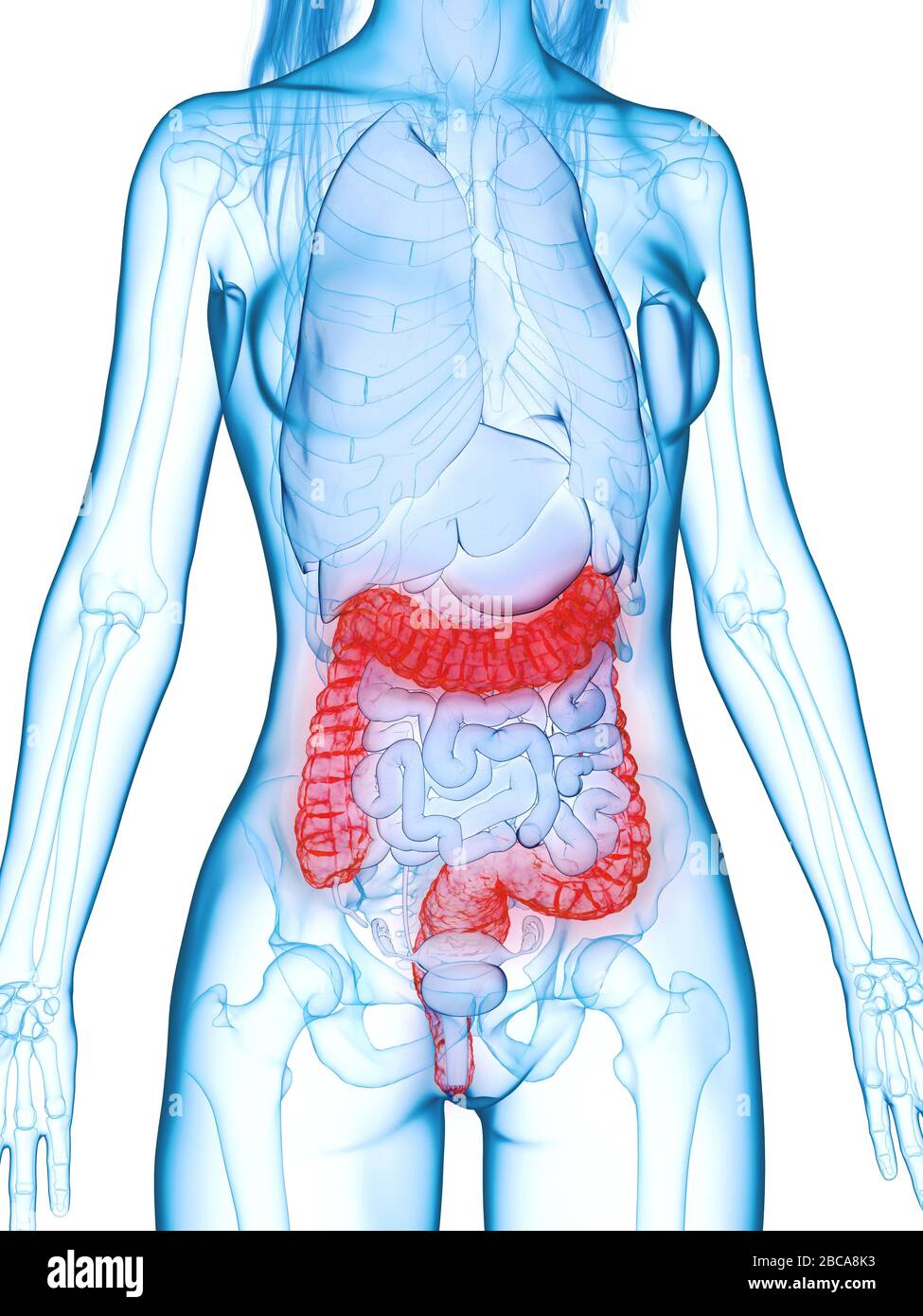 Damage Colon Diseased colon, illustration Stock Photo - Alamy