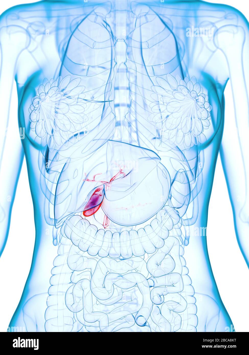 Diseased gallbladder, illustration. Stock Photo