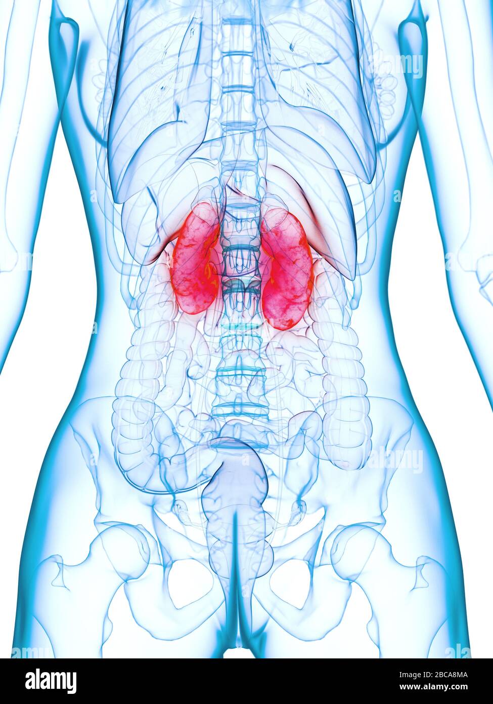 Diseased kidneys, illustration Stock Photo Alamy