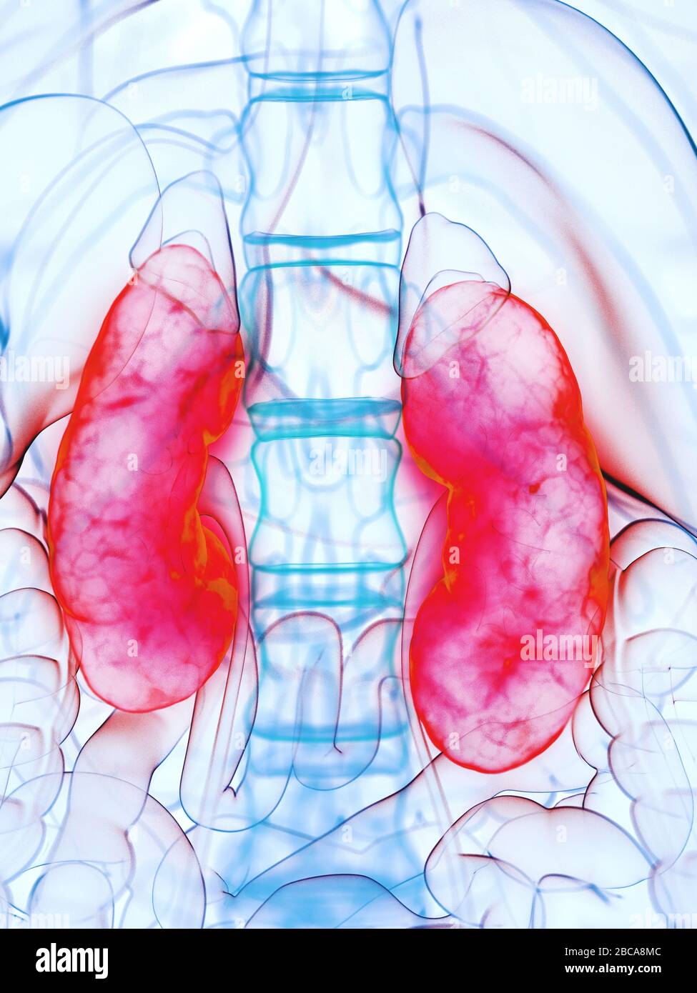 Diseased kidneys, illustration Stock Photo Alamy