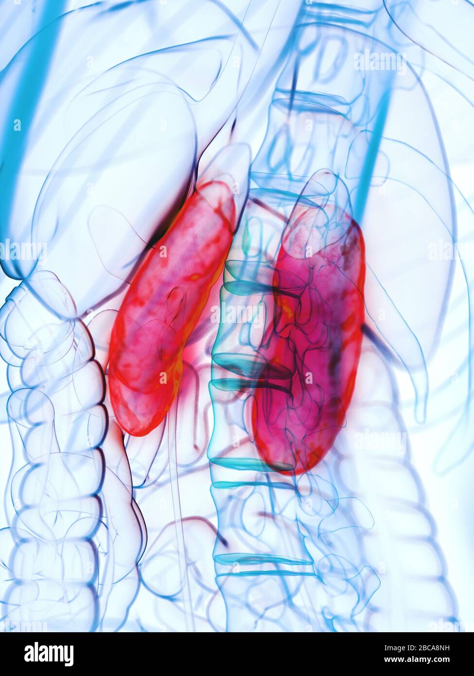 Diseased kidneys, illustration Stock Photo Alamy