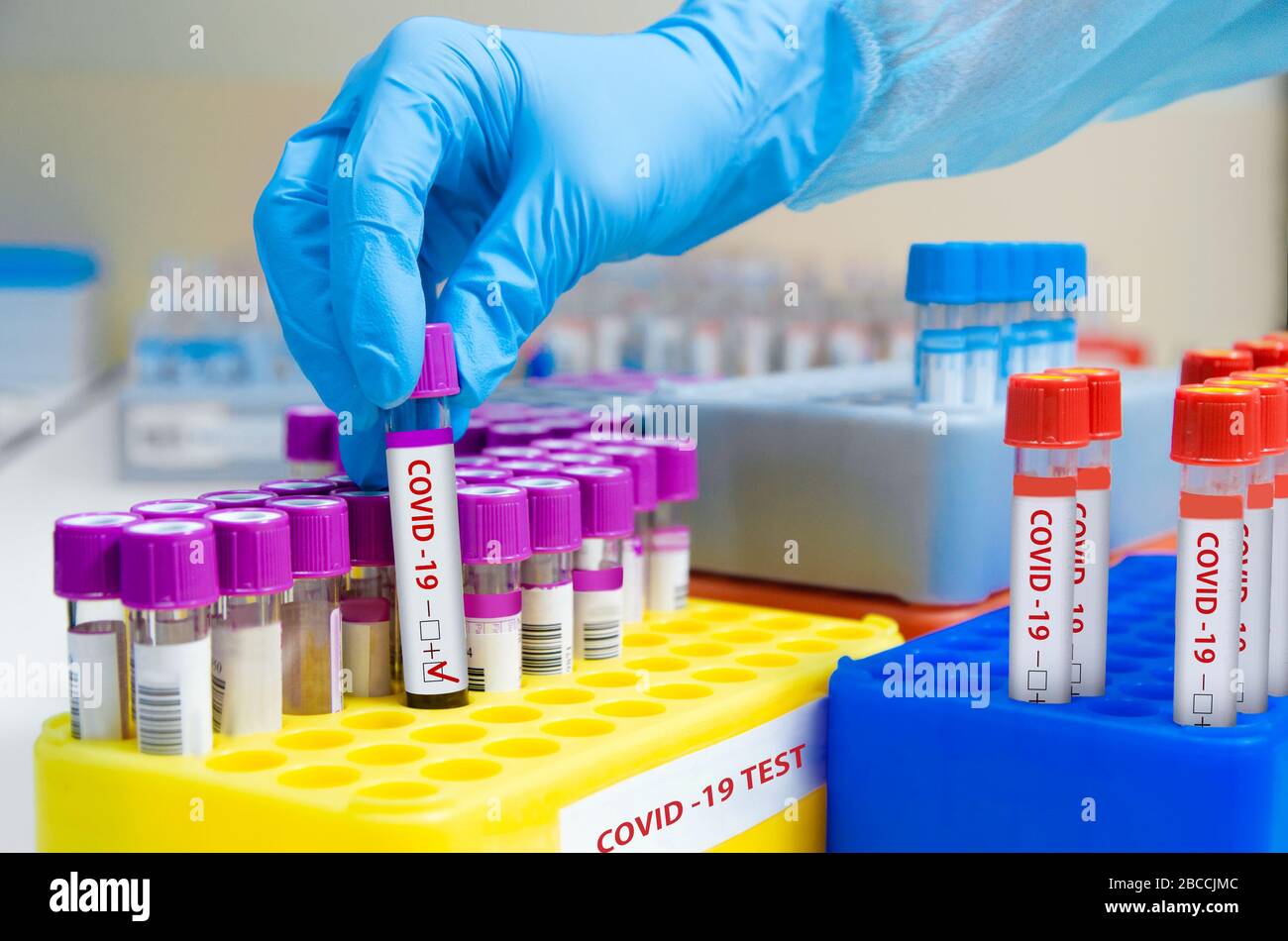 Positive test for Covid-19. An infected Covid-19 sample in a test tube with a label in the doctor's hand. Laboratory tube with SARS-CoV2. Laboratory C Stock Photo