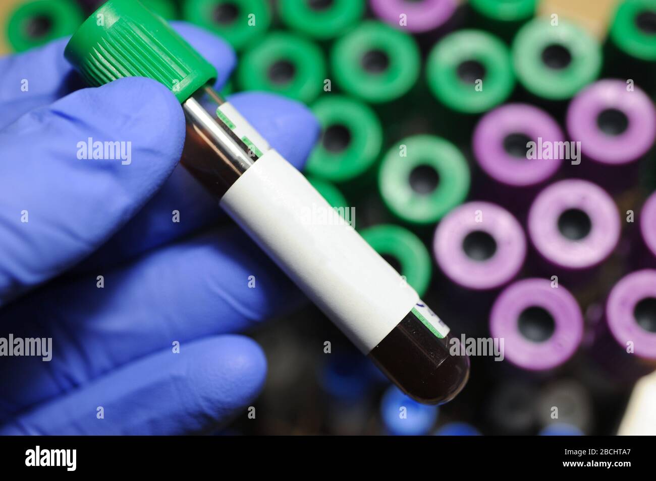 Test tube with blood for testing. Testing blood. Stock Photo