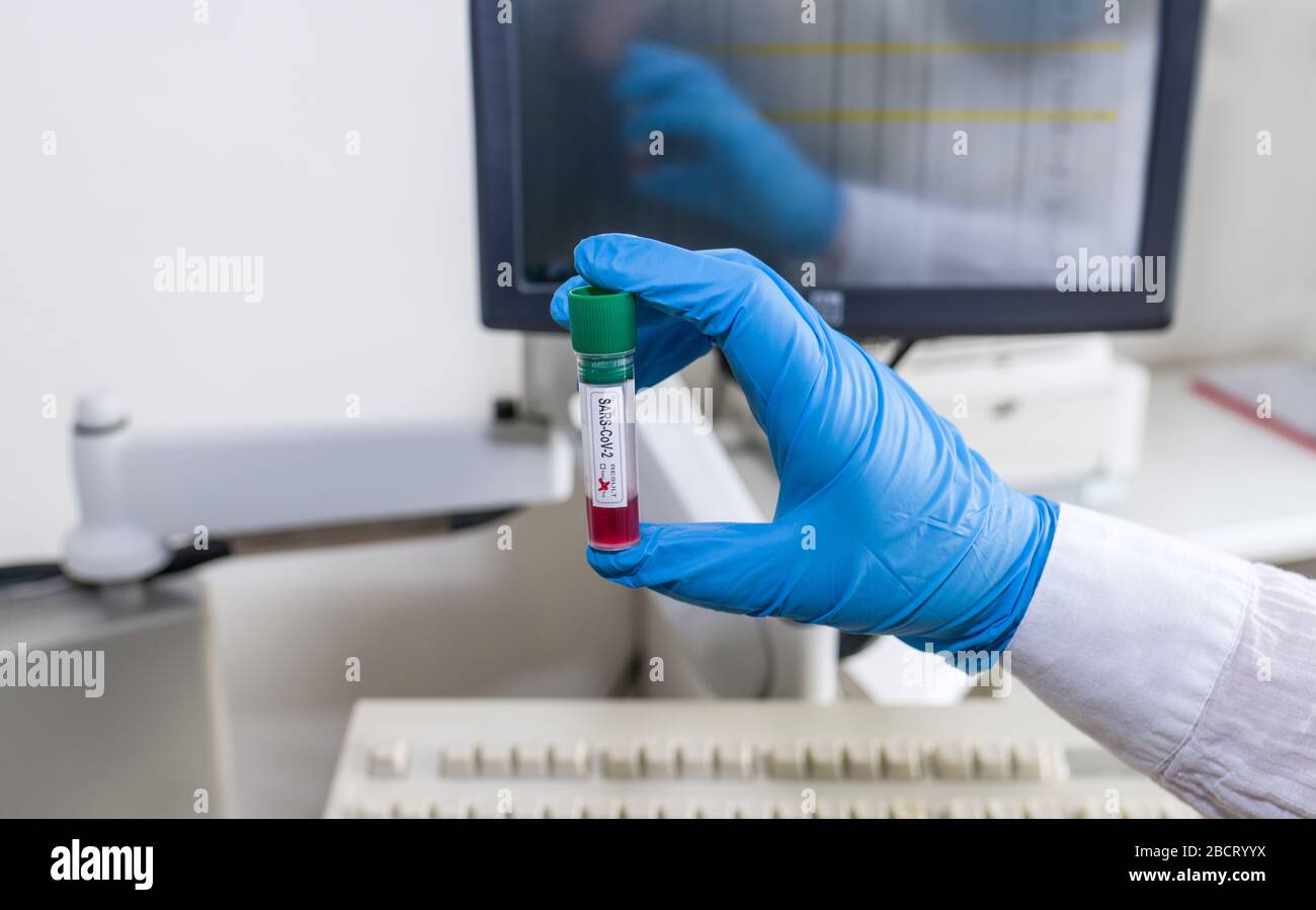 Laboratory expert holding SARS-CoV-2 sample test tube. Diagnostic automated analyzer. Hand mirroring, blue glove. Medical software on computer monitor. Stock Photo