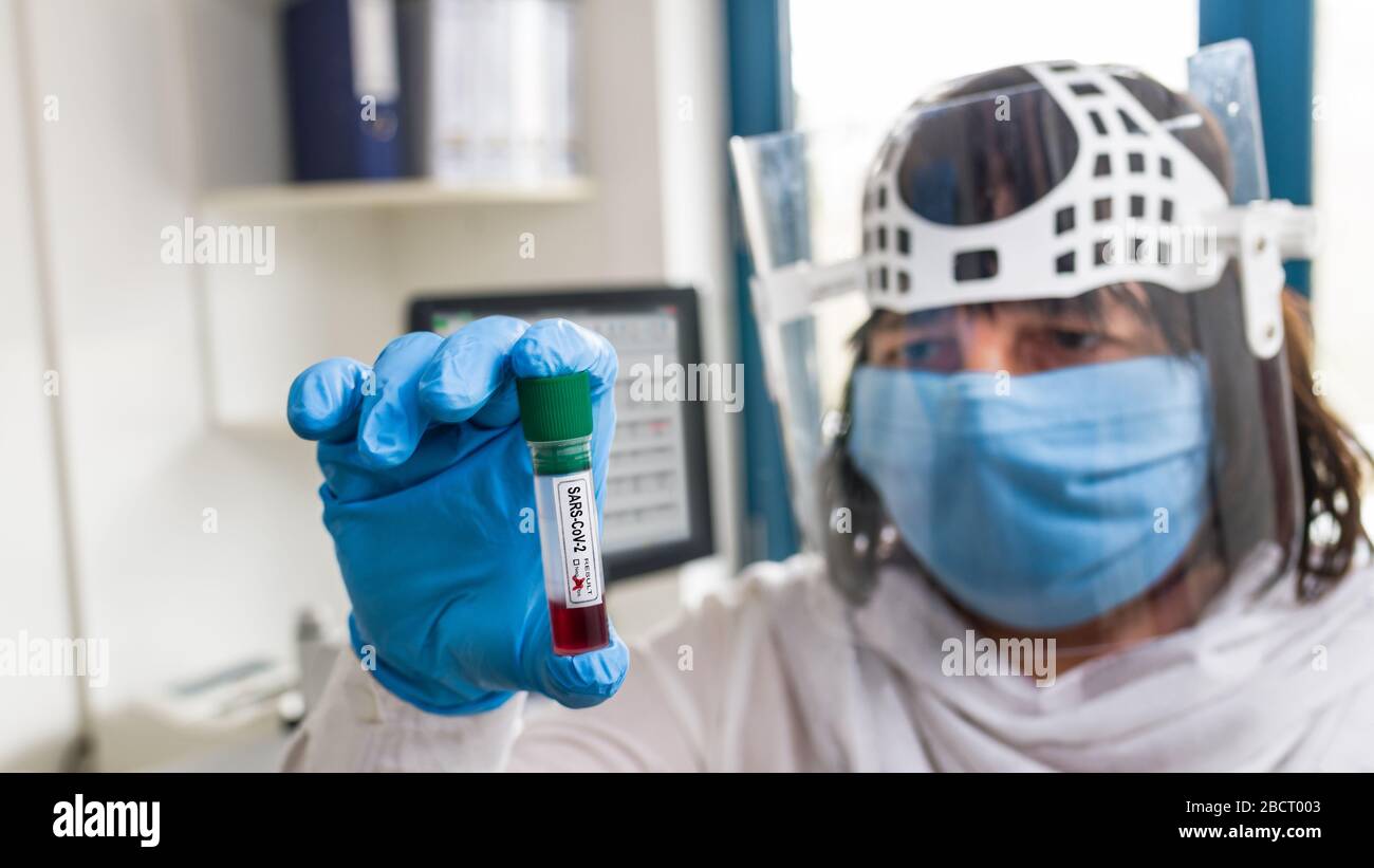 Test tube. Positive result SARS-CoV-2 blood sample in lab assistant hand. Female medic. Protective face mask or shield. COVID-19 diagnostic laboratory. Stock Photo