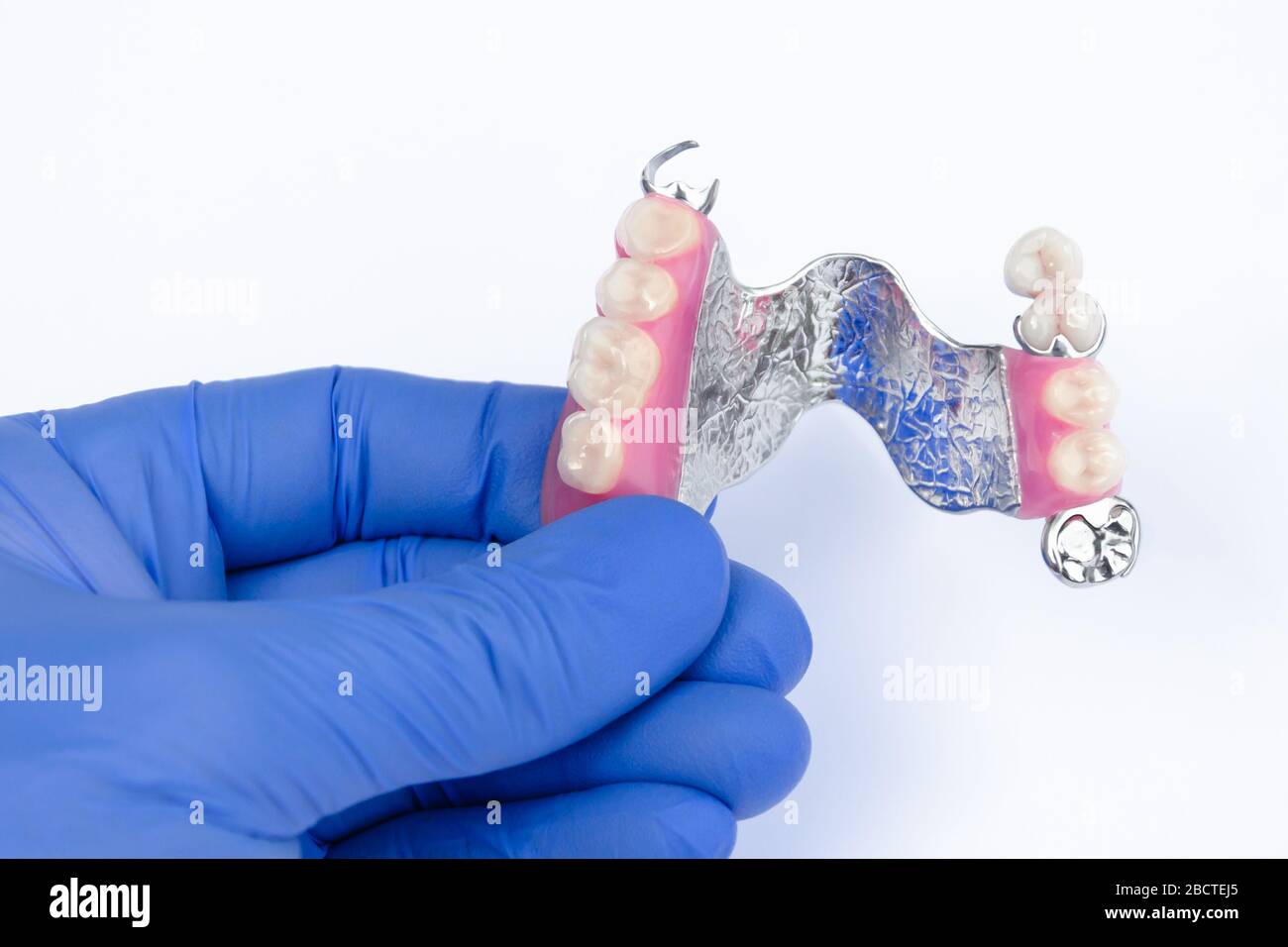 Removable dental prosthesis hires stock photography and images Alamy