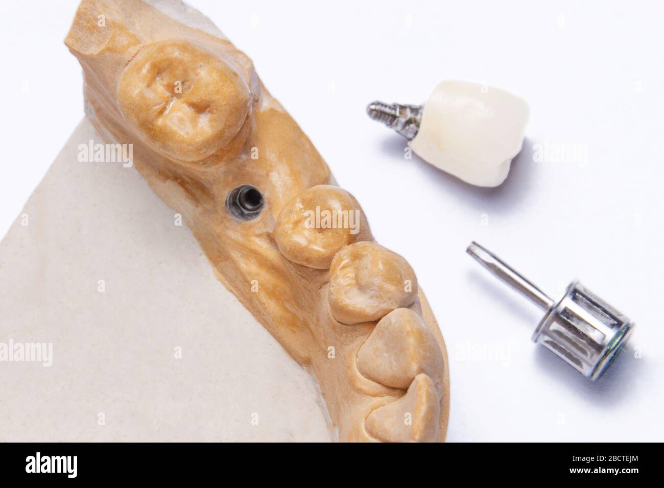 dental implant in the lower jaw close-up. gypsum model of the lower jaw with a crown on the implant and a screwdriver are isolated on a white backgrou Stock Photo