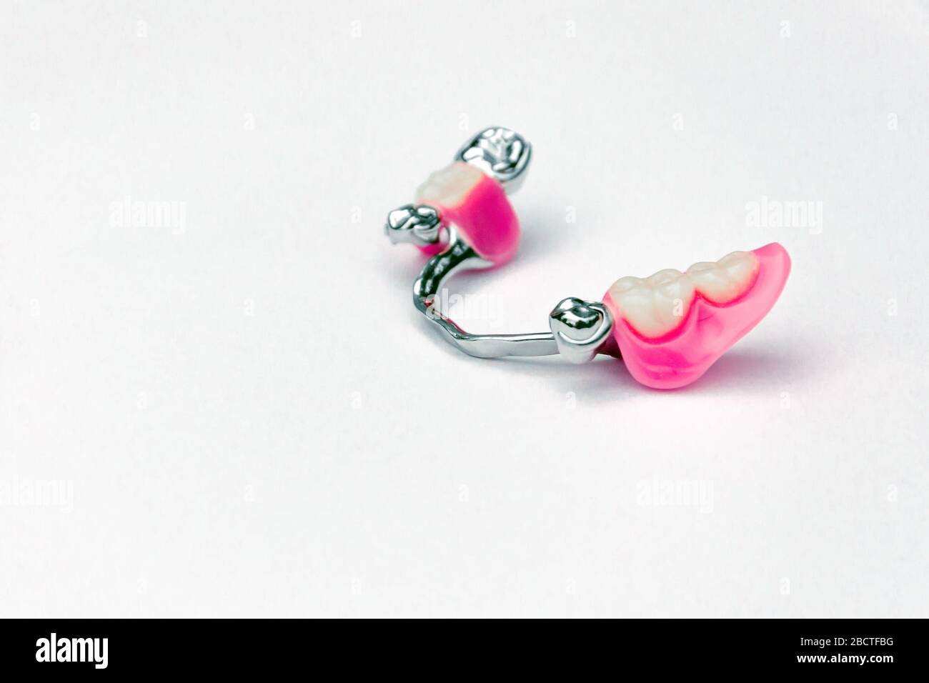 arch removable prosthetics. prosthetics using removable dentures. lower