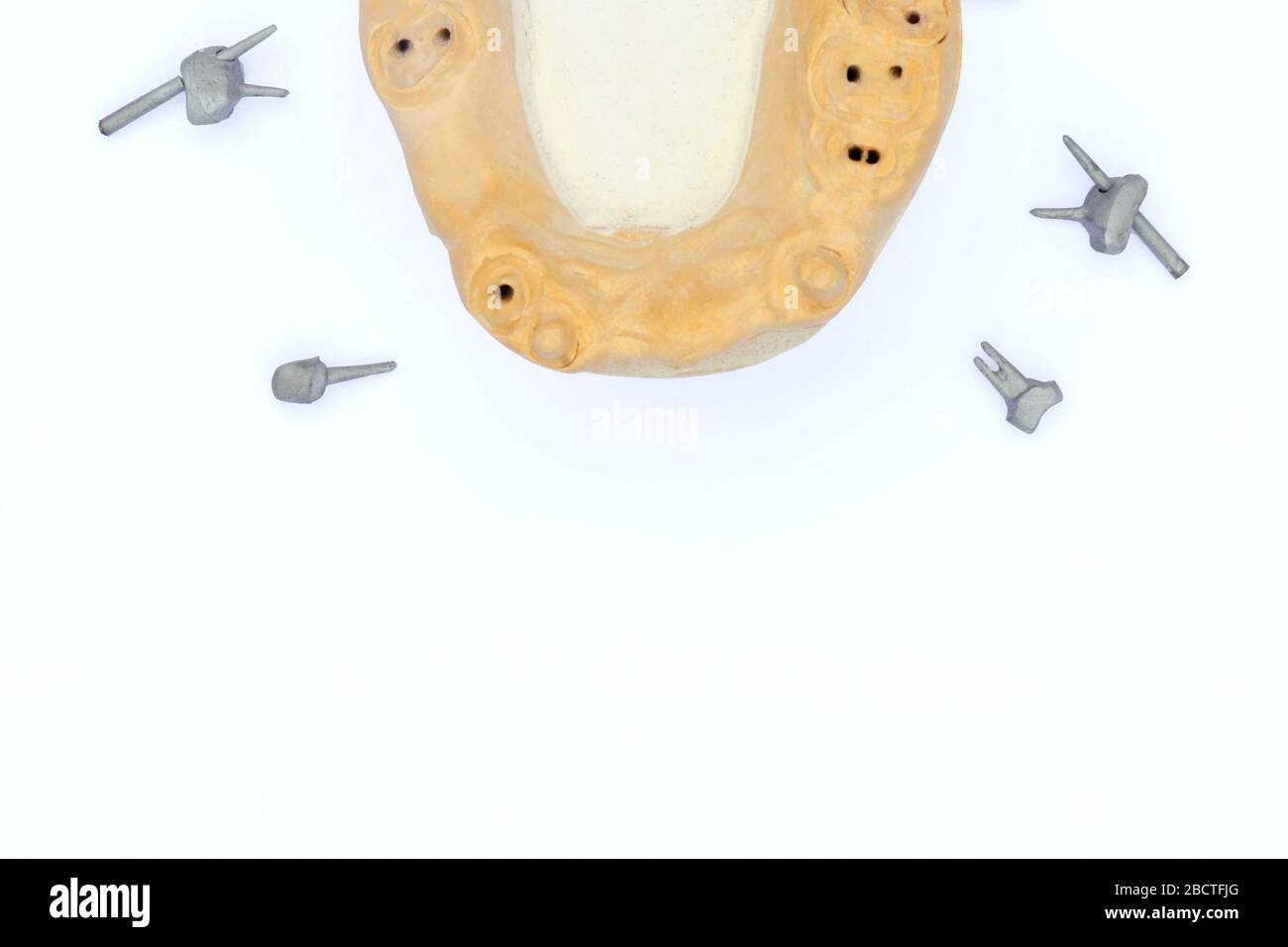 dental metal pins. cast pins with a plaster model of the jaw isolated on a white background. background for the dental laboratory. concept of orthoped Stock Photo