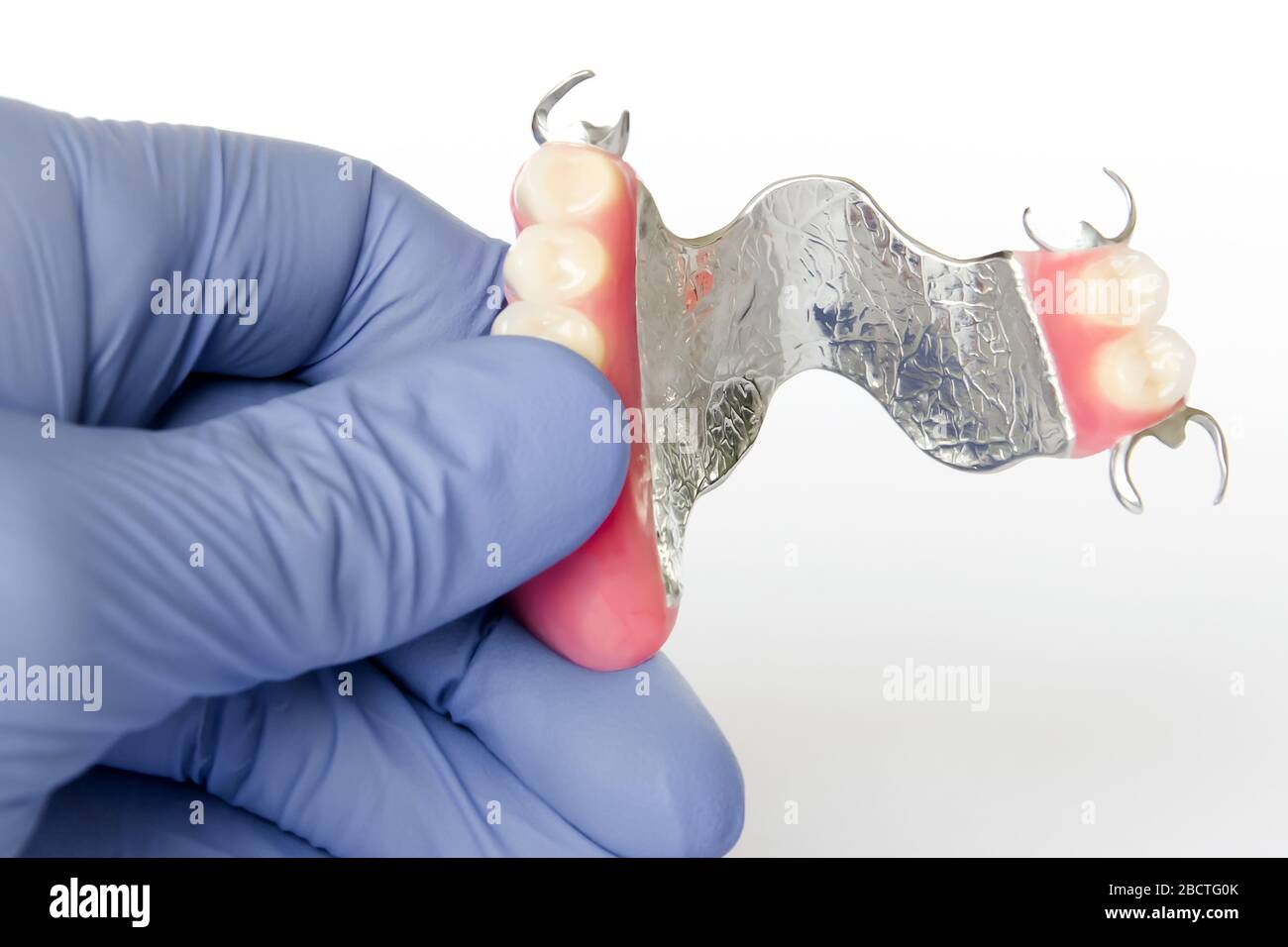 removable clasp prosthesis with clam fixation on the upper jaw in the hands of the dentist Stock Photo