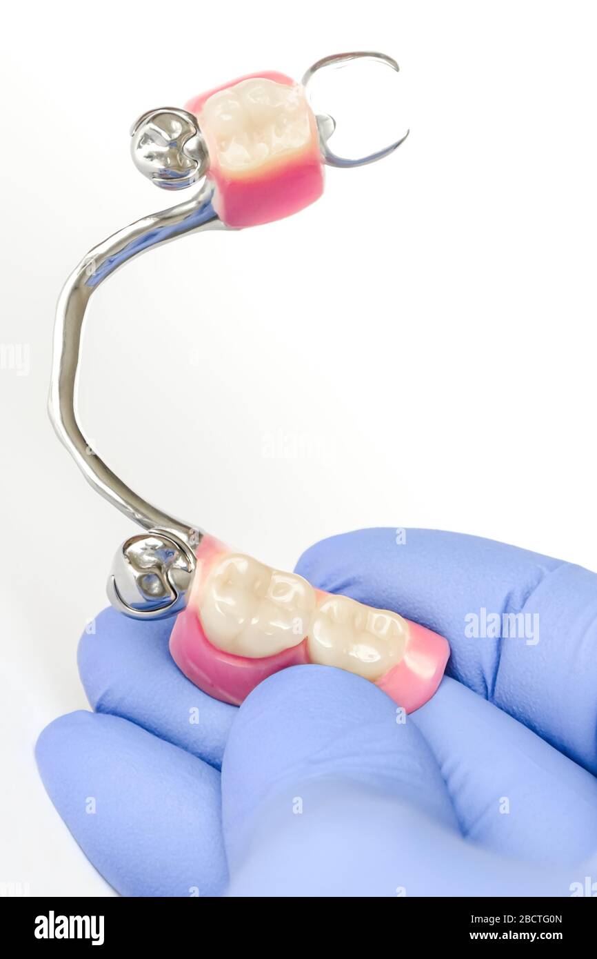 clasp denture on the lower jaw with supporting crowns in the hands of