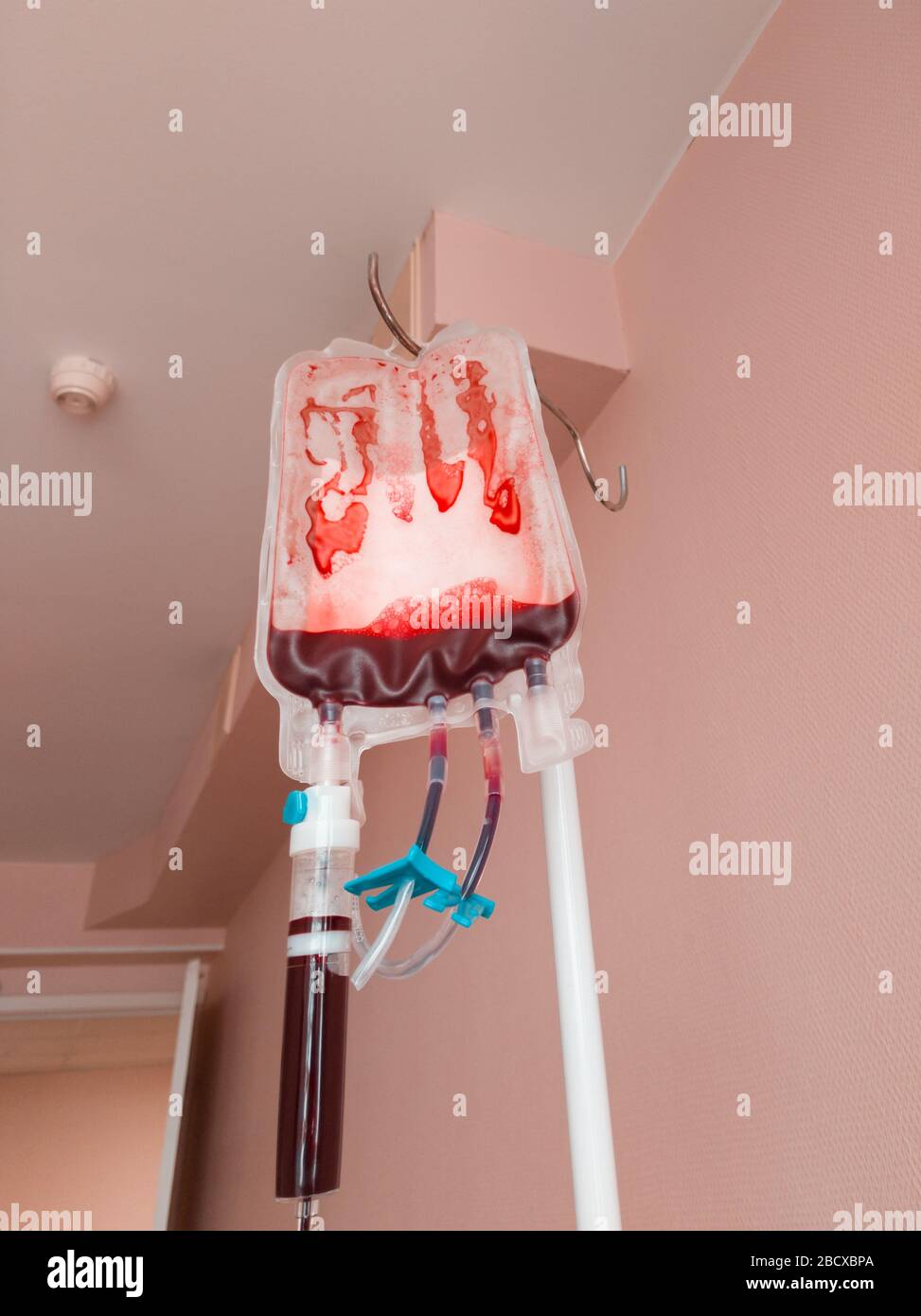 Blood transfusion at the final stage of the operation. Almost empty blood bag on a rack. Vertical photo Stock Photo