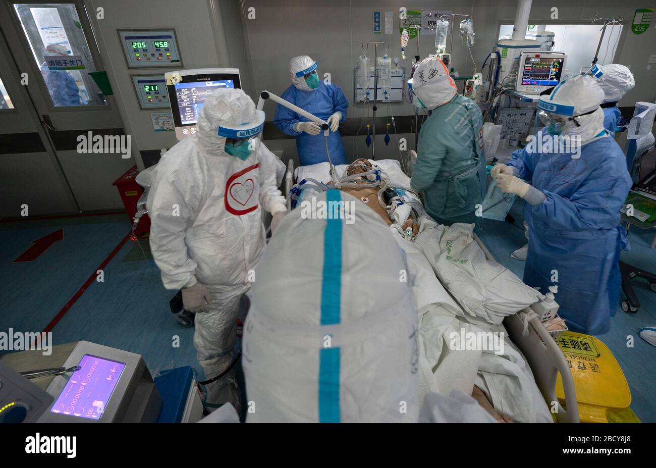 Wuhan, China's Hubei Province. 5th Apr, 2020. Medical staff prepare to take off the ECMO machine used to support senior Hu's lungs at the Wuhan pulmonary hospital in Wuhan, capital of central China's Hubei Province, April 5, 2020. A patient surnamed Hu, a 40-year-old severe case of the COVID-19 who was diagnosed with the disease in early February, has the functions of his lungs recovered on Sunday at the Wuhan pulmonary hospital with days of extracorporeal membrane oxygenation (ECMO) support. Credit: Fei Maohua/Xinhua/Alamy Live News Stock Photo