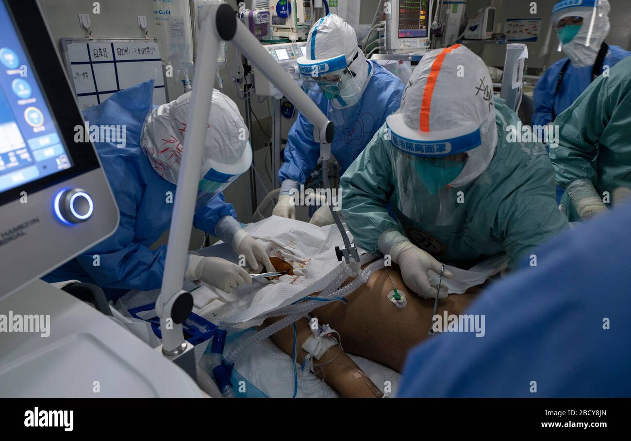 Wuhan, China's Hubei Province. 5th Apr, 2020. Medical staff take off the ECMO machine used to support senior Hu's lungs at the Wuhan pulmonary hospital in Wuhan, capital of central China's Hubei Province, April 5, 2020. A patient surnamed Hu, a 40-year-old severe case of the COVID-19 who was diagnosed with the disease in early February, has the functions of his lungs recovered on Sunday at the Wuhan pulmonary hospital with days of extracorporeal membrane oxygenation (ECMO) support. Credit: Fei Maohua/Xinhua/Alamy Live News Stock Photo