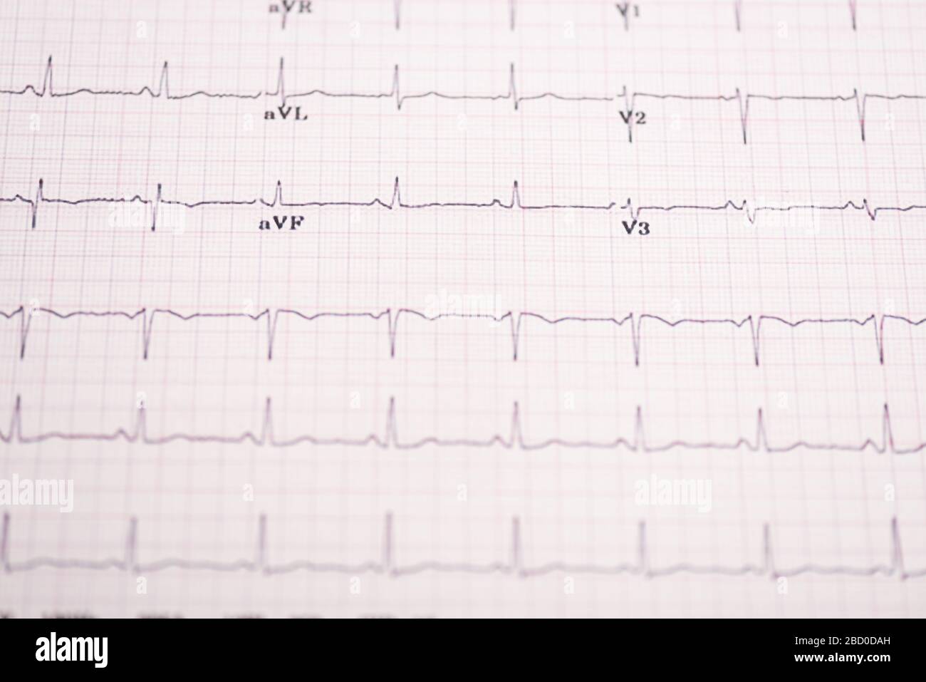 Close up electrocardiogram equipment hi-res stock photography and ...