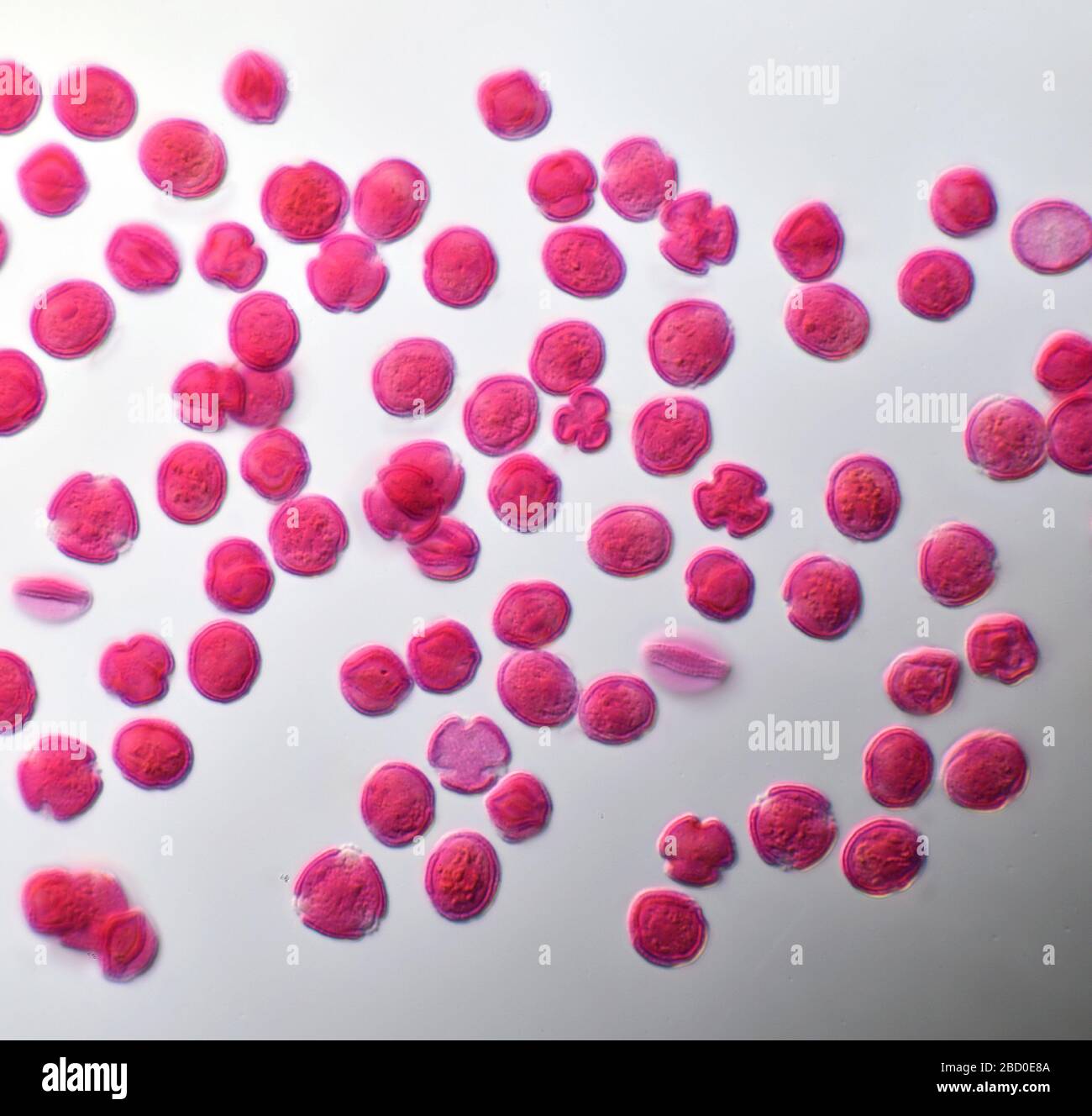DIC Normarski photomicrograph pollen of Japanese anemone, Anemone japonica. Stock Photo