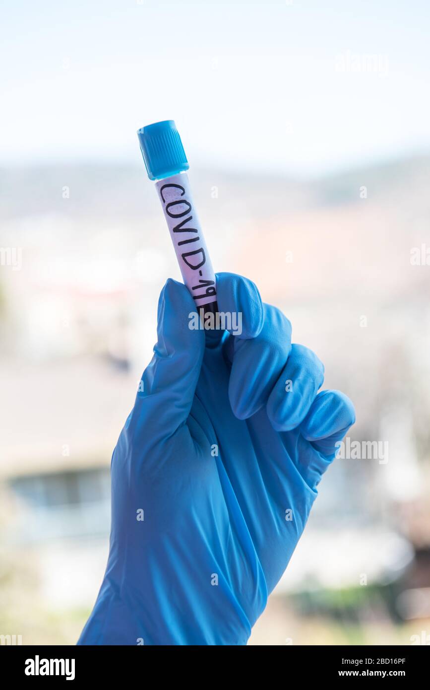 Tube with blood and test at covid-19. Stock Photo