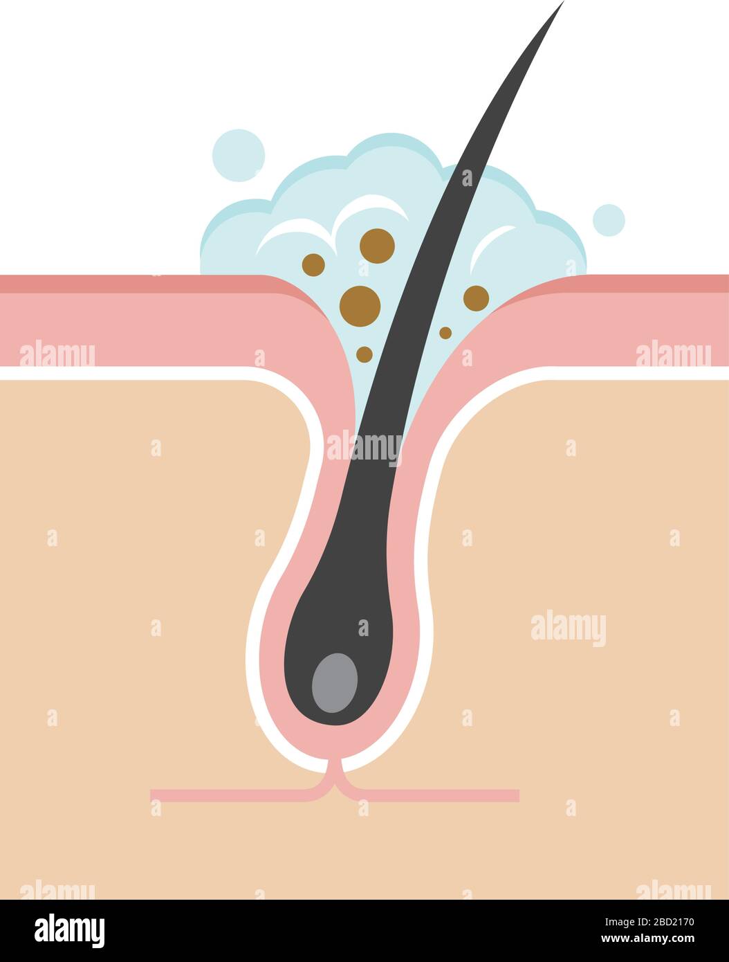 Structure illustration of pores /cleansing, clear keratotic plug (whitehead). Stock Vector