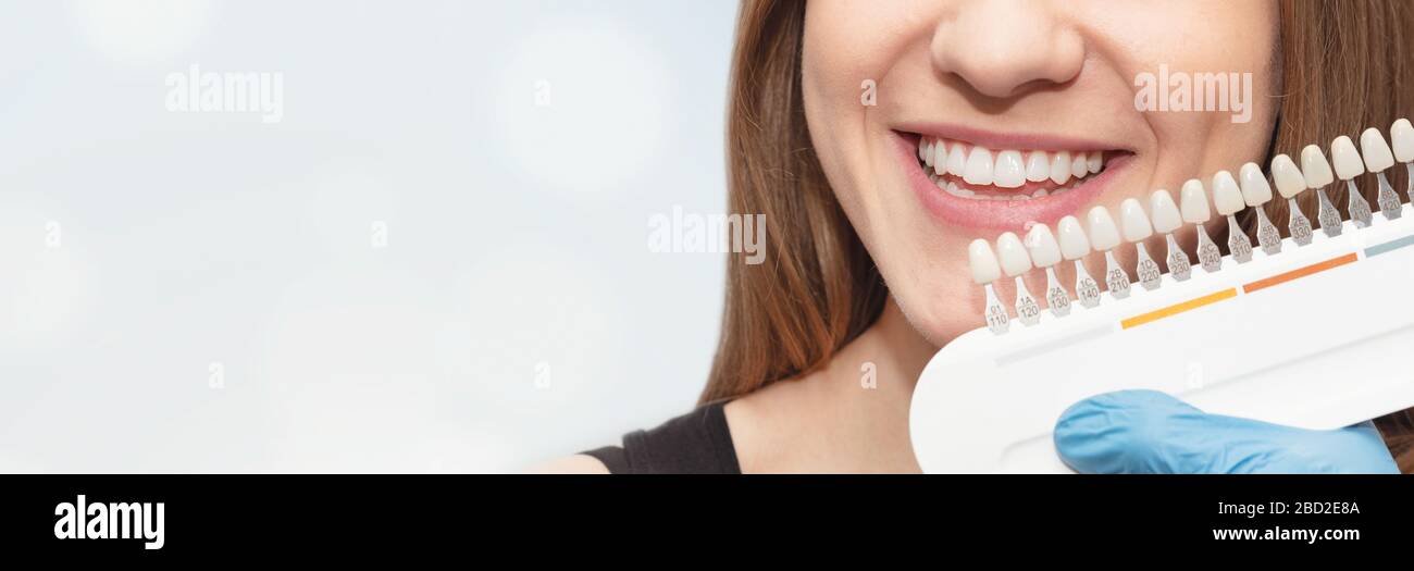 Teeth whitening process. Set of implants with various shades of tone