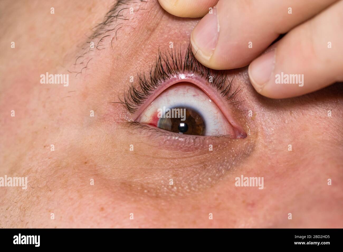 1000pcs cotton eye care Under Eye Pads Disposable Eye Patch Eyeshadow | eBay