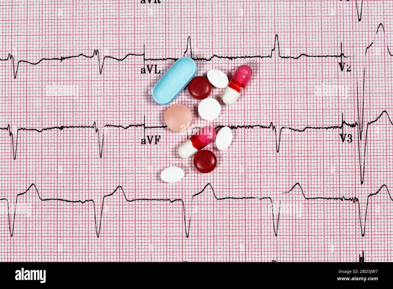 Close Up Echocardiograph test report (ECG) showing abnormal heart rhythm with medication Stock Photo