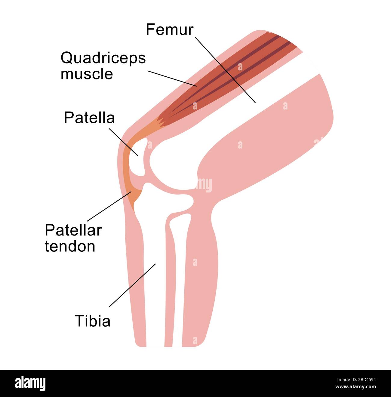 Osgood-schlatter disease (knee joint disease) illustration Stock Vector