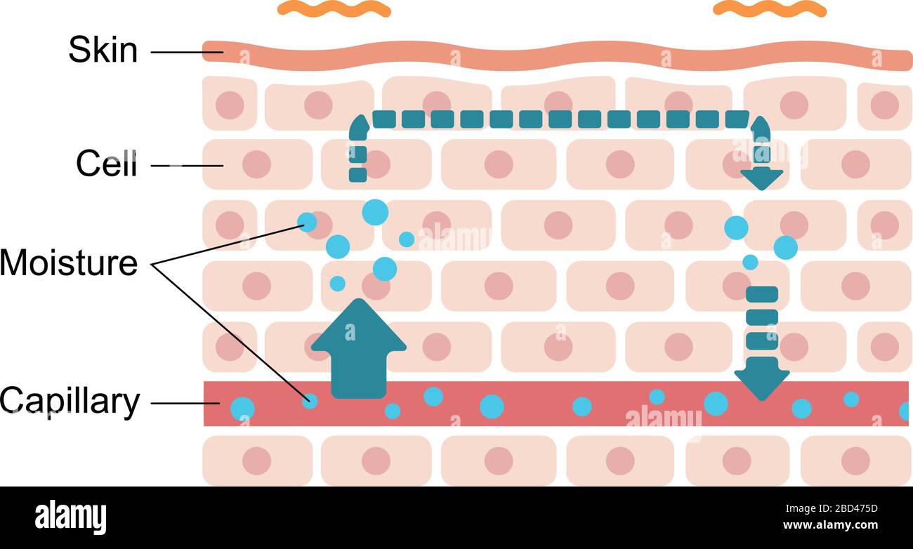 Illustration of swollen skin condition (Malfunction of moisture