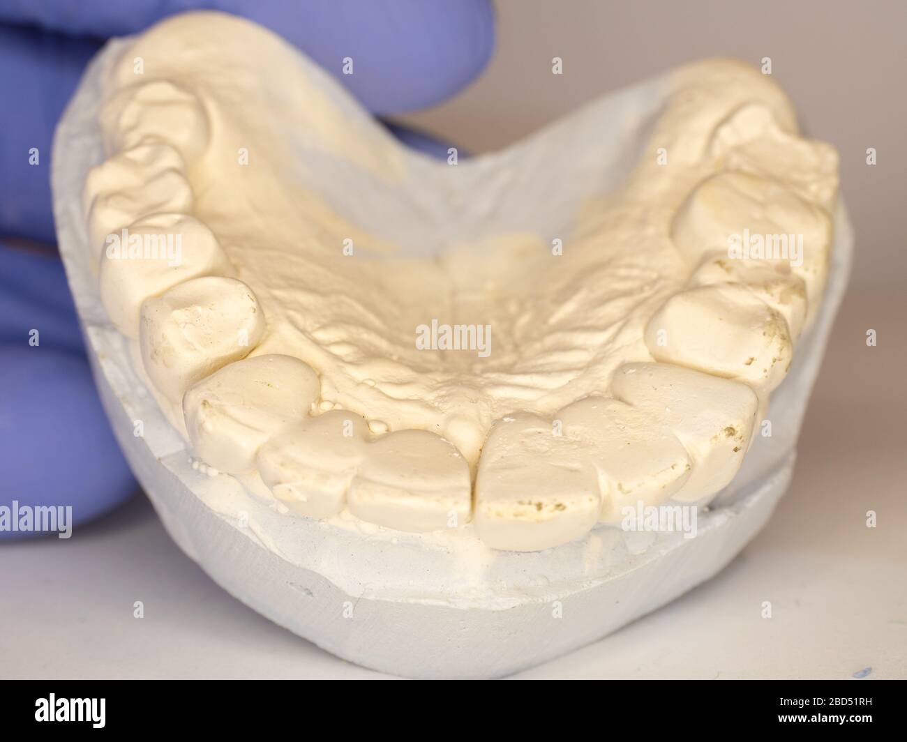 Dental gypsum model mould of teeth in plaster Stock Photo - Alamy
