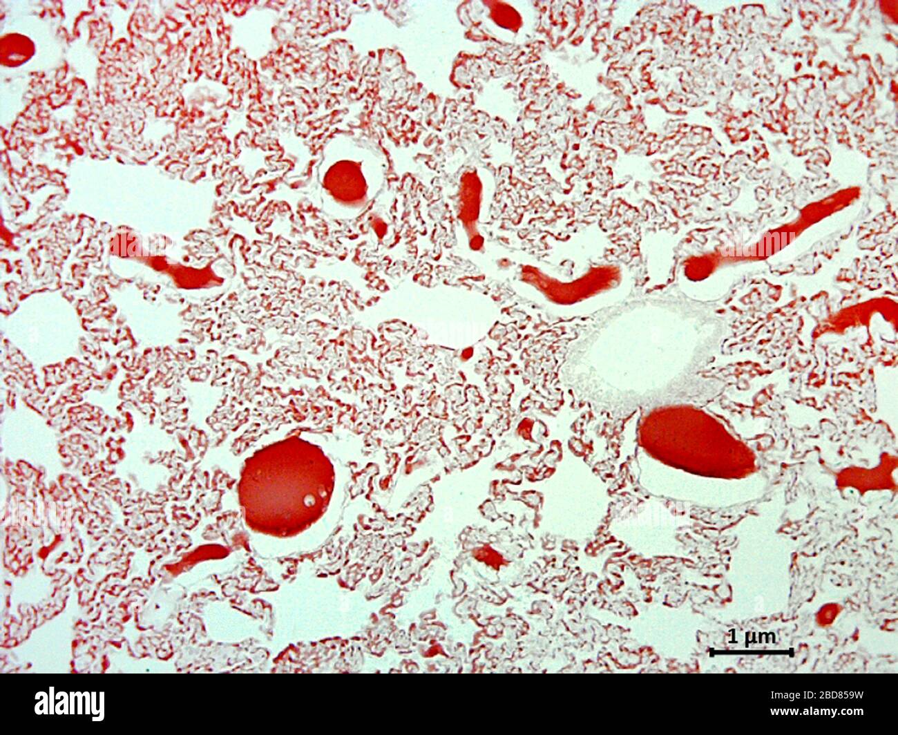 Brown rat, Common brown rat, Norway rat, Common rat (Rattus norvegicus), histological cut of tissue of a lunge with bloodvessel, 500 x Stock Photo