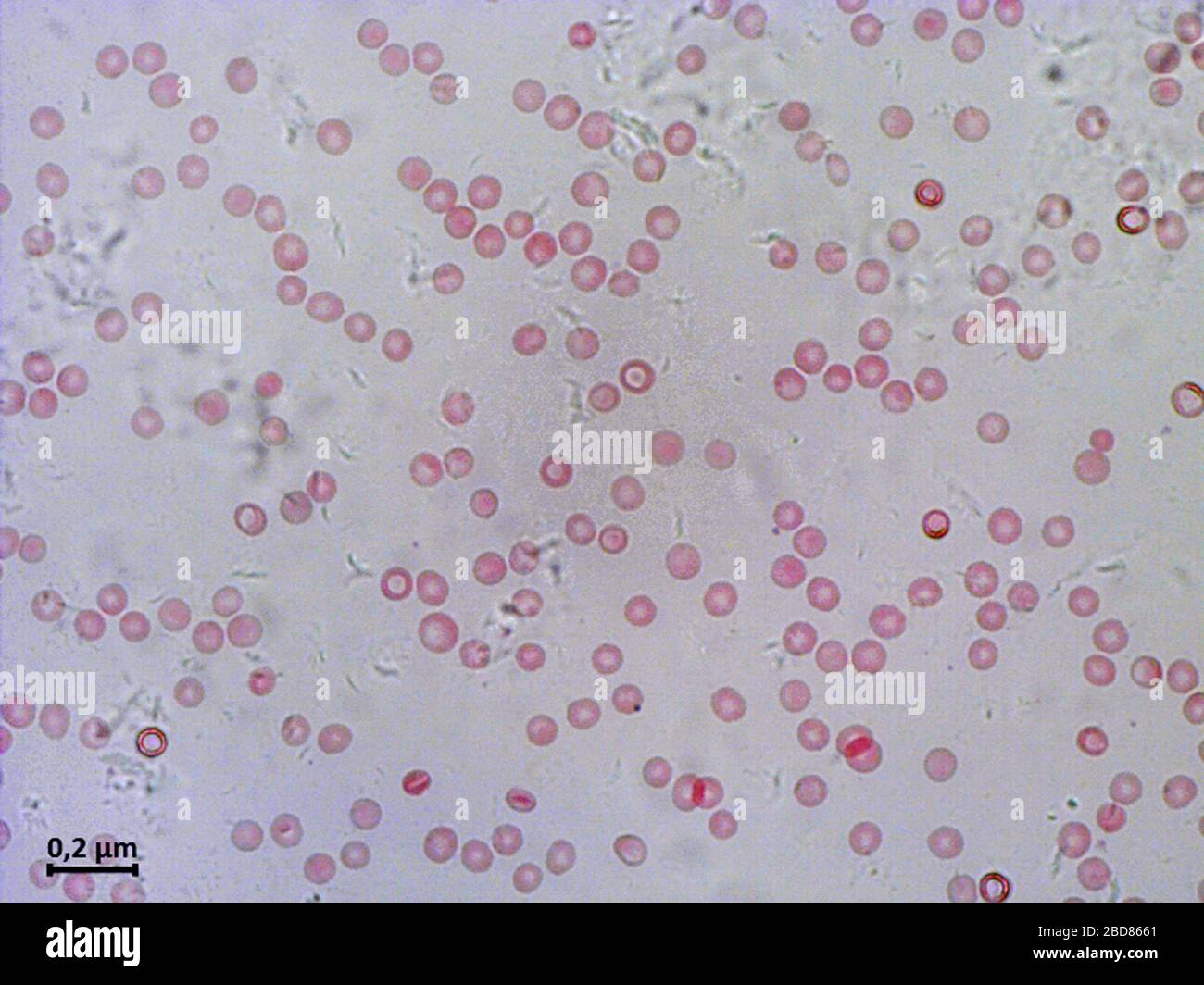 human blood smear, 2000x Stock Photo
