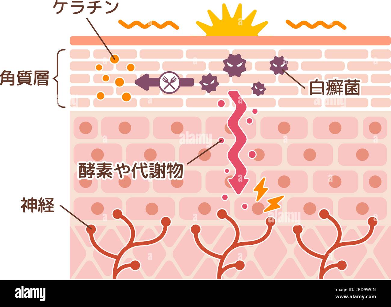 Generation mechanisim of athlete's foot ( ringworm) vector illustration / Japanese Stock Vector