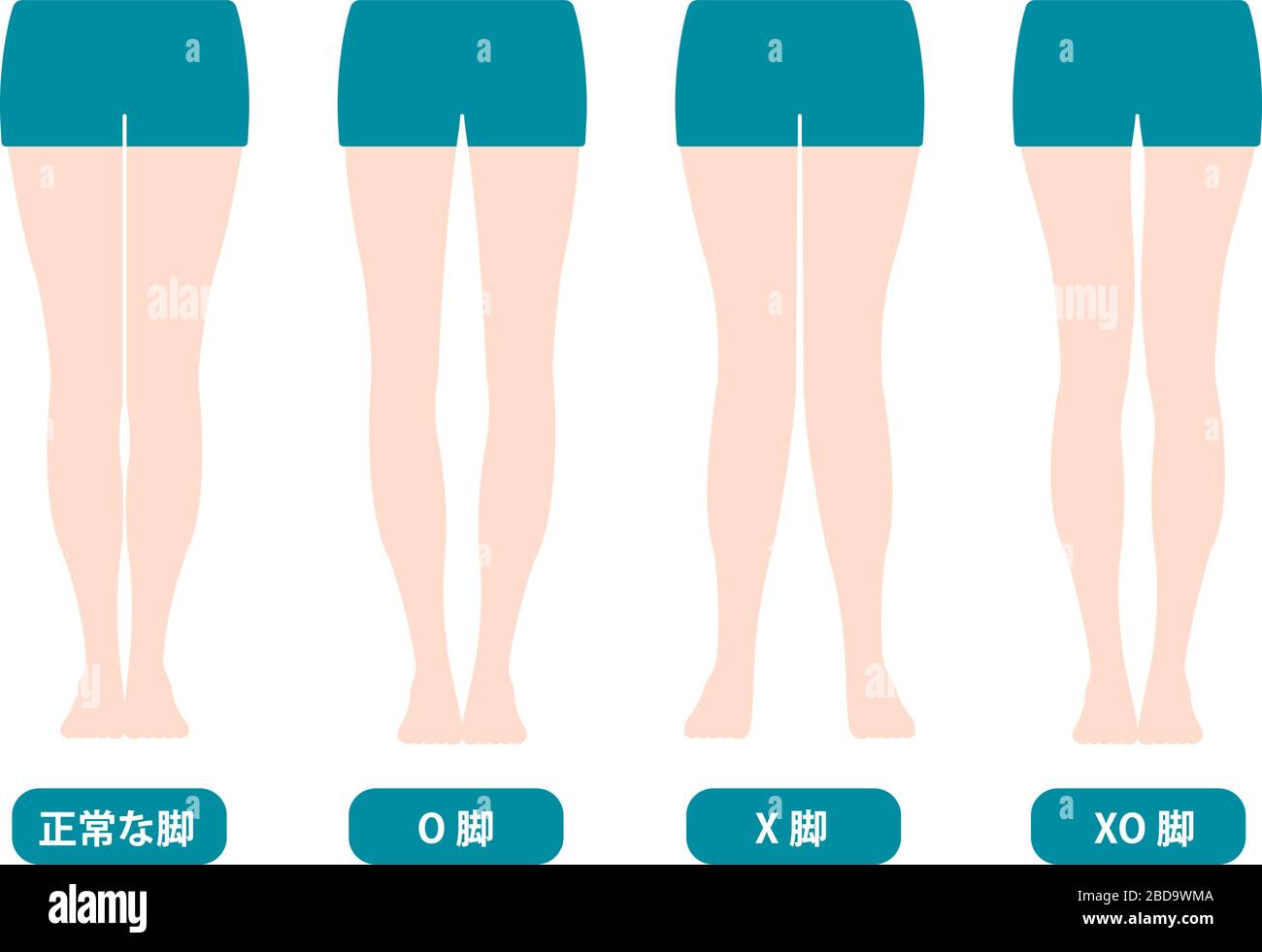 Difference types of legs angles and knees vector illustration (Japanese) Stock Vector