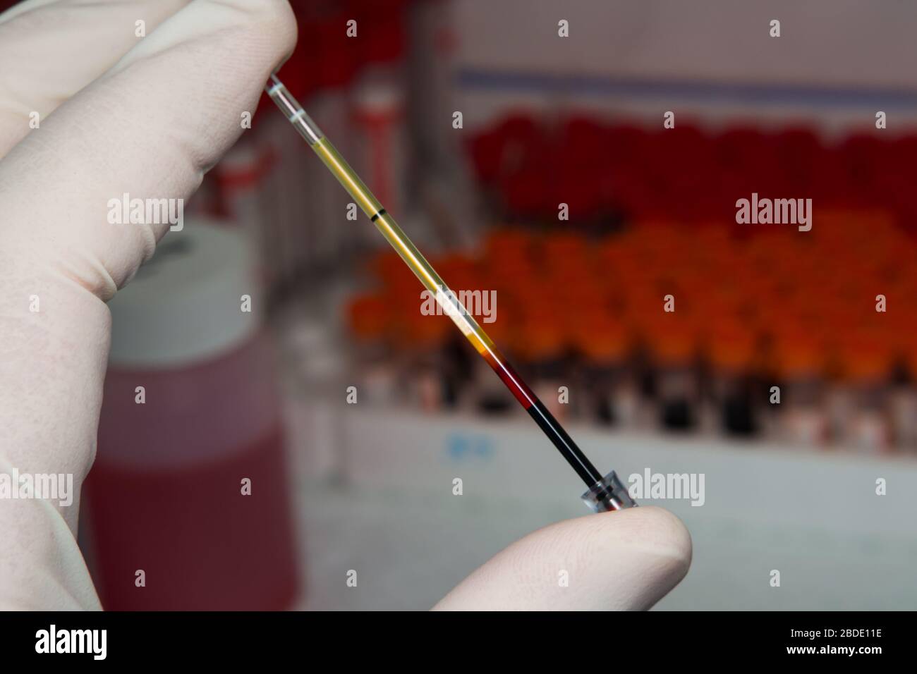 close-up photo of a blood sample in the hand of a laboratory worker ...