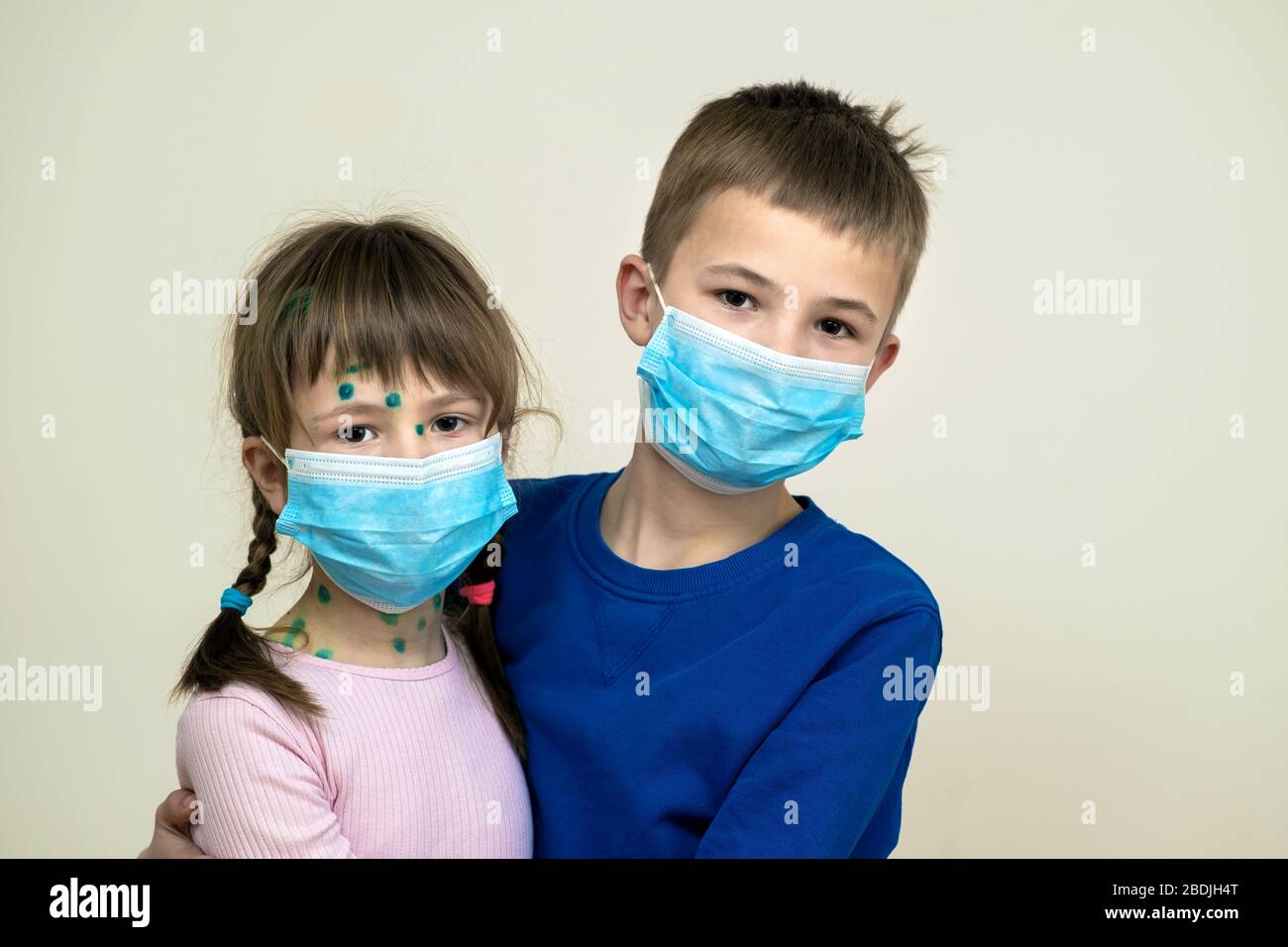 Boy and girl wearing blue protective medical mask ill with chickenpox, measles or rubella virus with rashes on body. Children protection during epidem Stock Photo