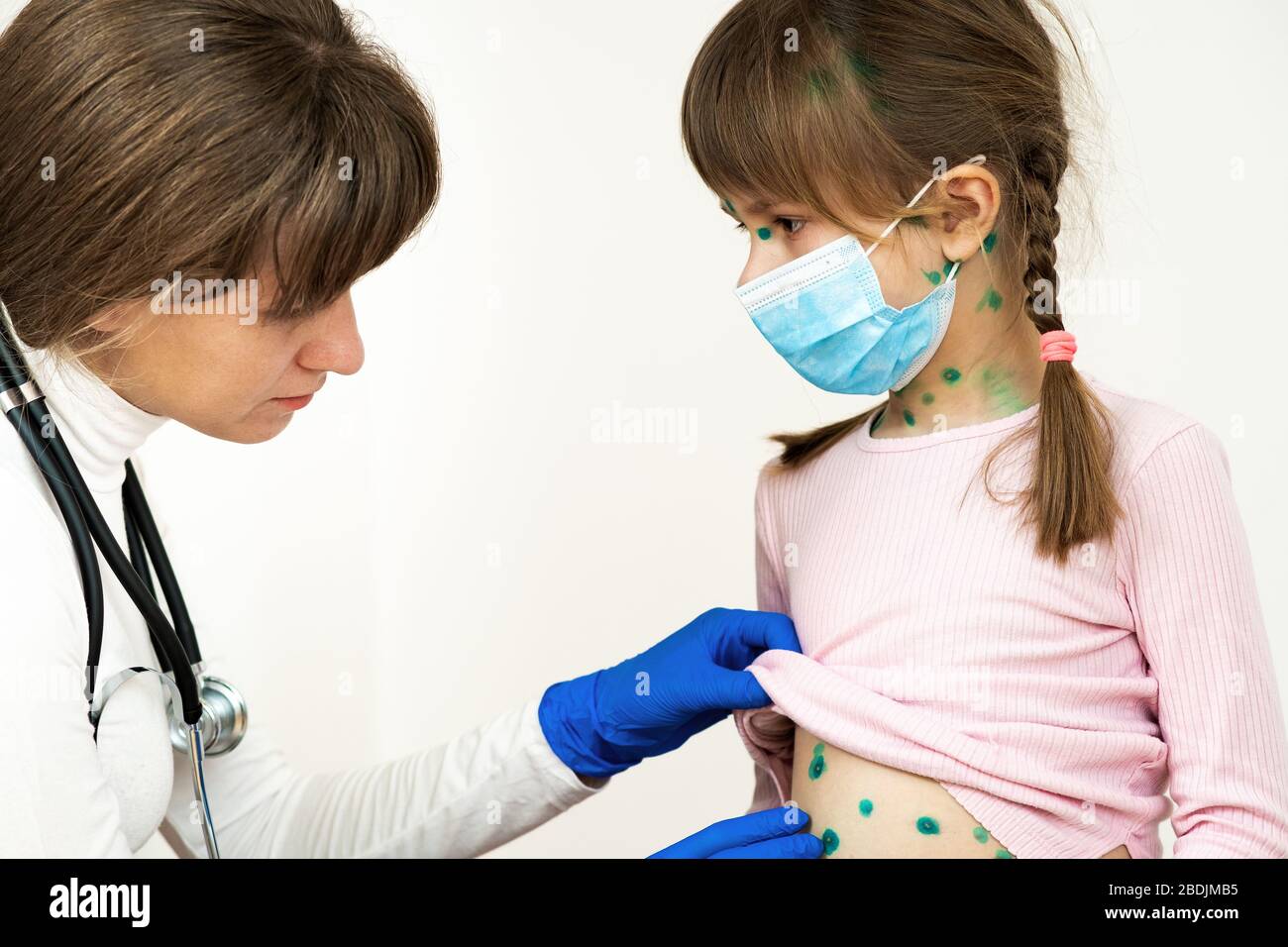 Doctor examining child girl covered with green rashes on face and stomach ill with chickenpox, measles or rubella virus. Stock Photo