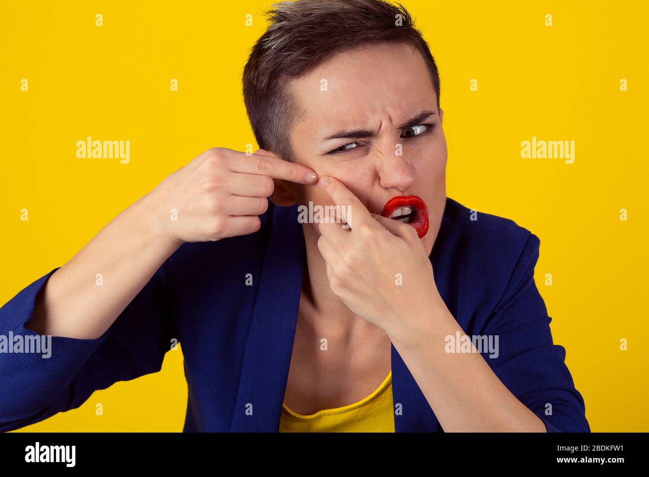Closeup Portrait frustrated young business woman has find problems with the skin, squeezing a pimple on her cheek isolated yellow background. Negative Stock Photo