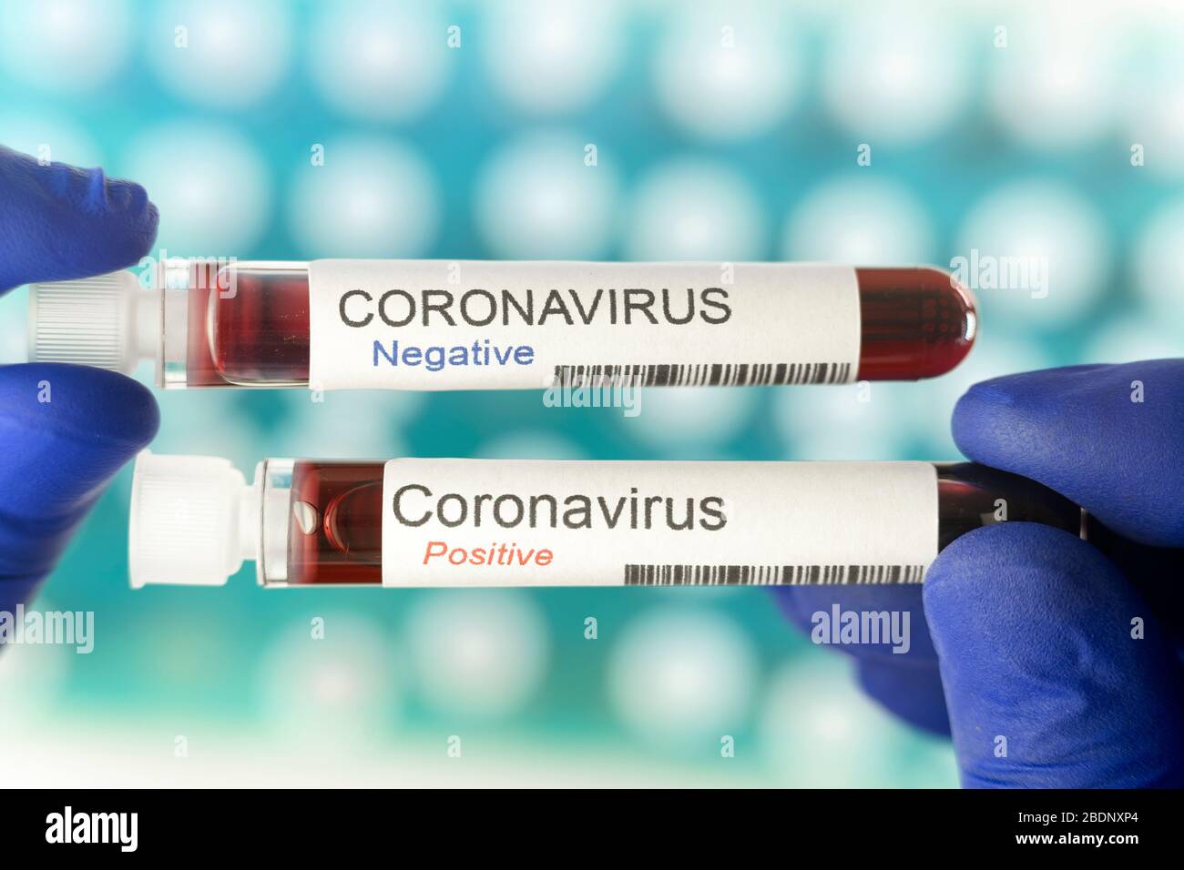 Coronavirus tests - one positive and one negative hold by a laboratory worker Stock Photo
