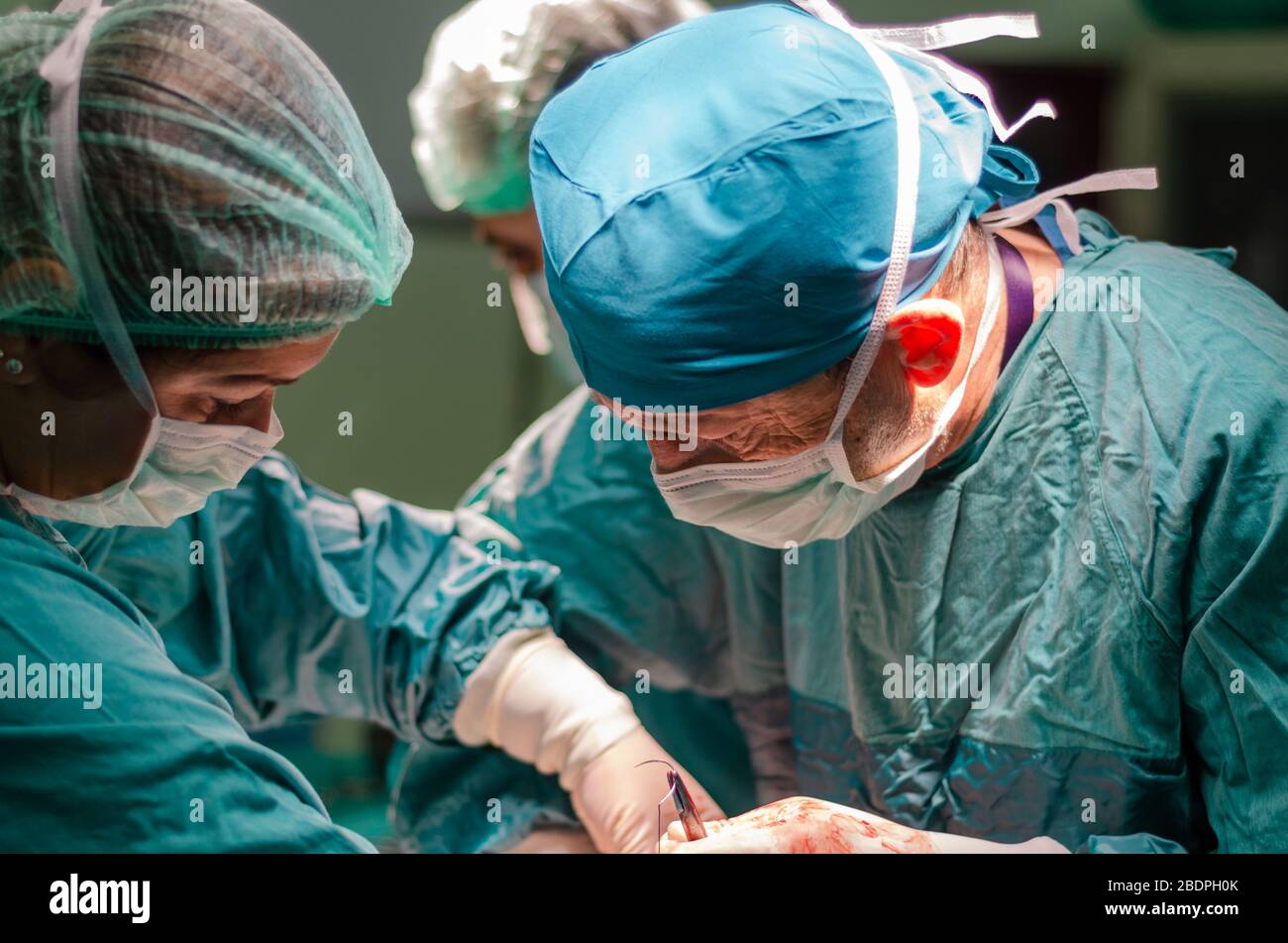 Hysterectomy procedure hires stock photography and images Alamy
