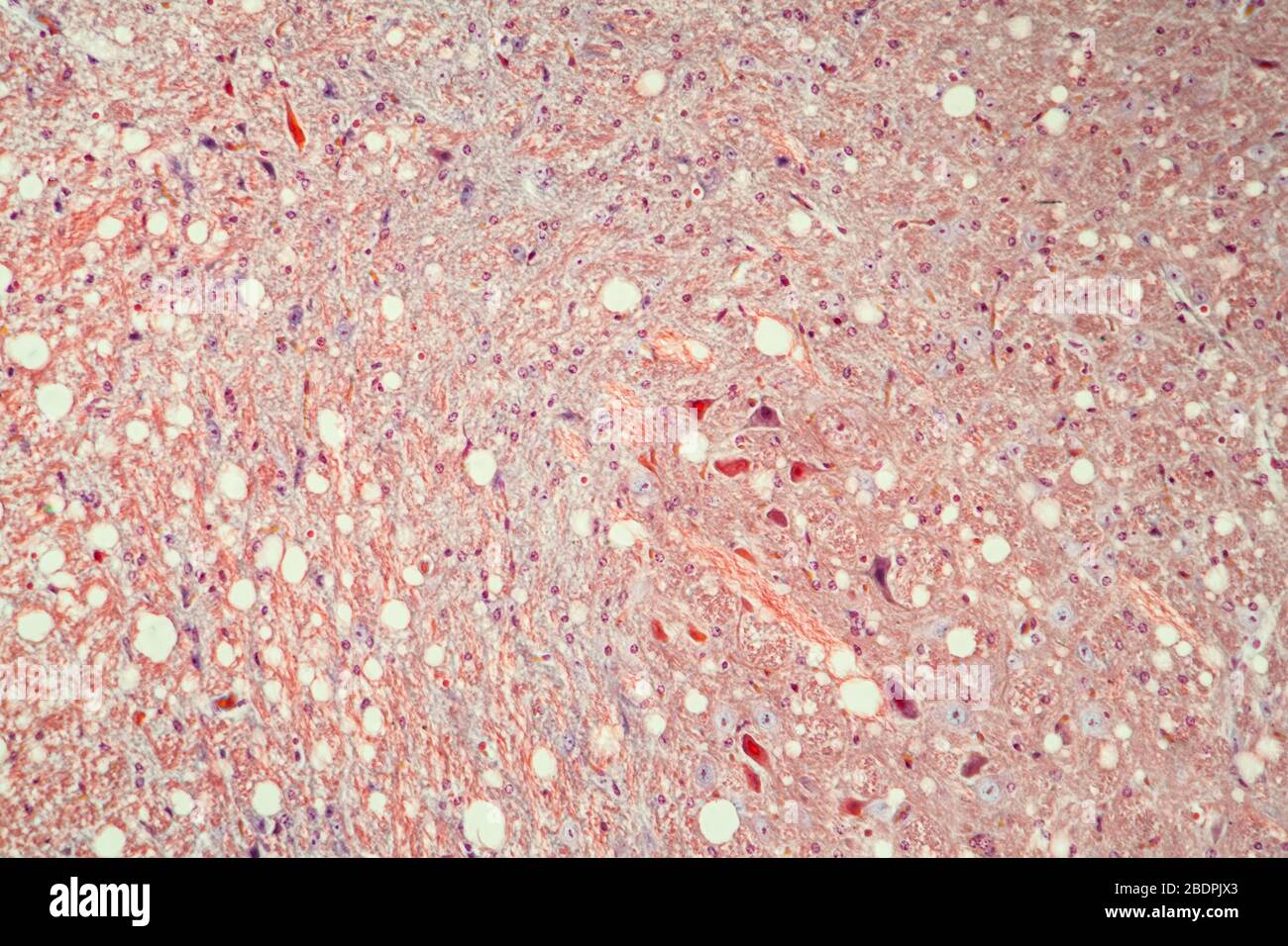 Brain cells tissue under the microscope 100x Stock Photo - Alamy