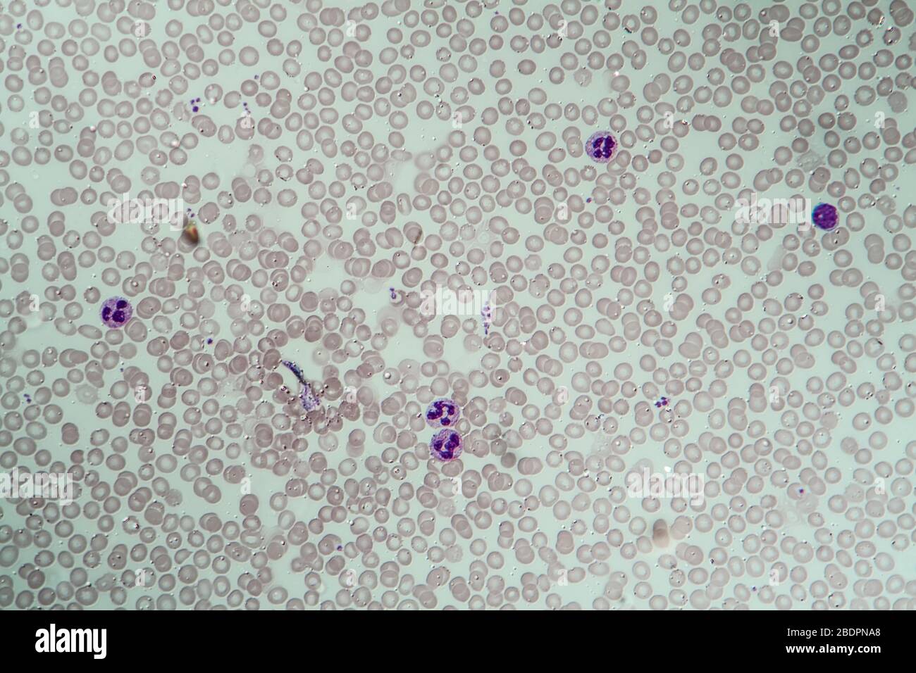 A) Microphotograph of HCPT-MVLs at × 400 magnification; (B) size