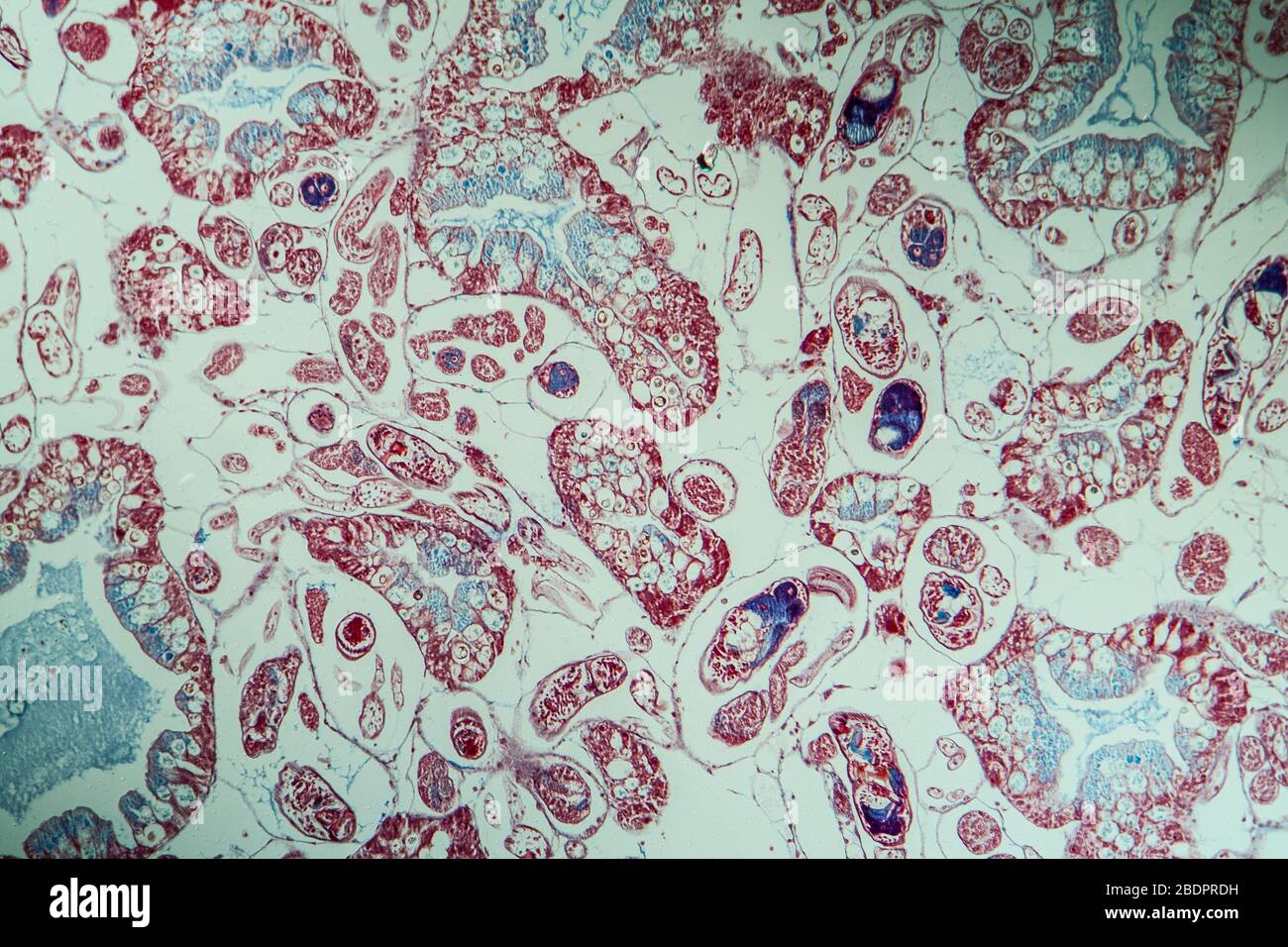 Infection with liver fluke tissue section 100x Stock Photo - Alamy