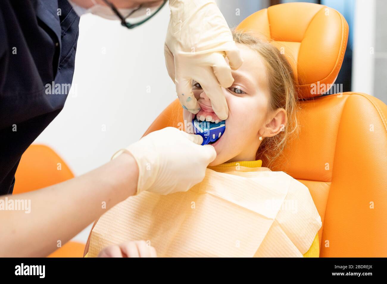 Orthodontist , tooth kids braces ,equipment teeth cast.Disorders of the