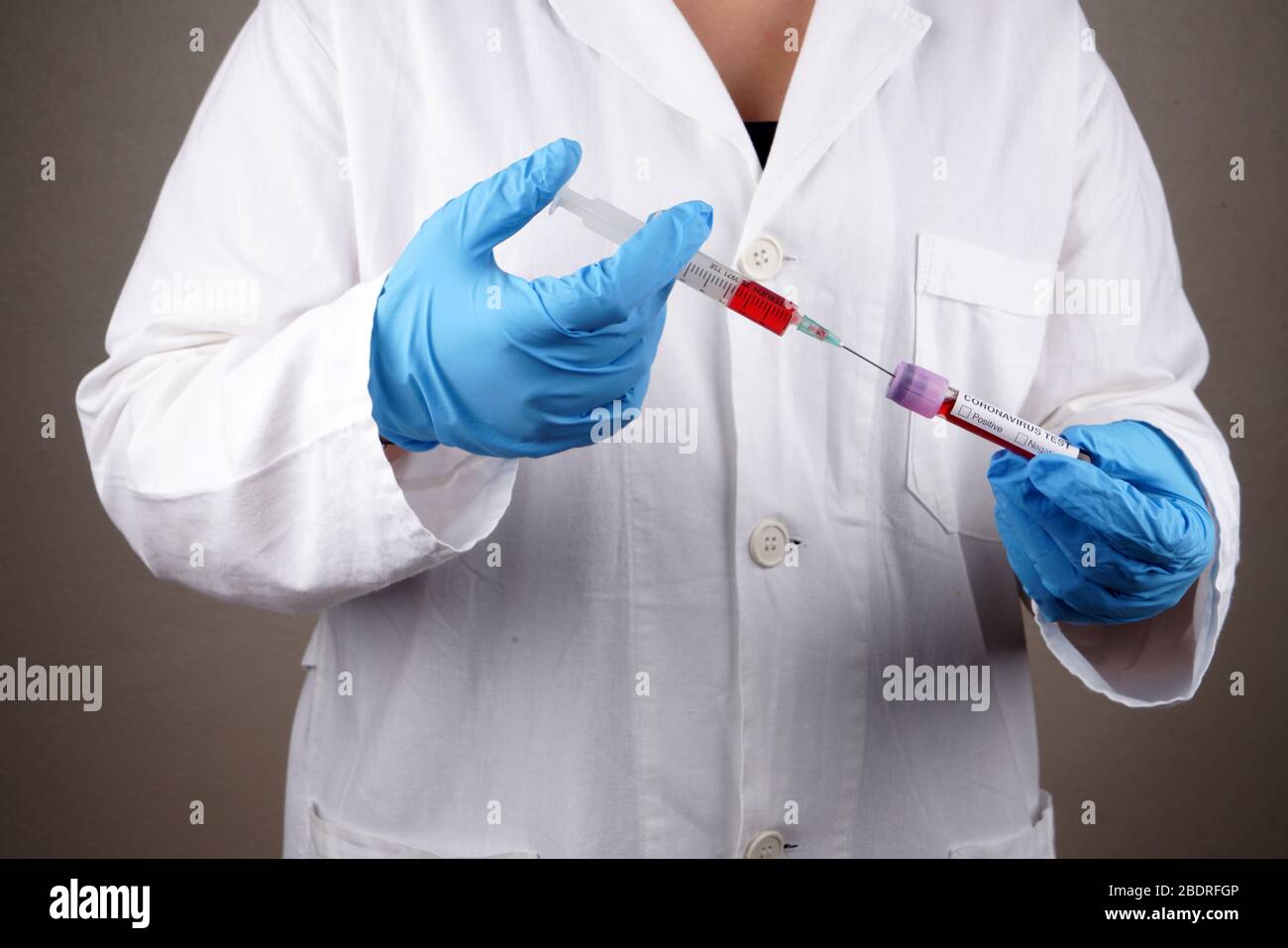Set of preparation of blood plasma from the test tube in a syringe of blood plasma Stock Photo