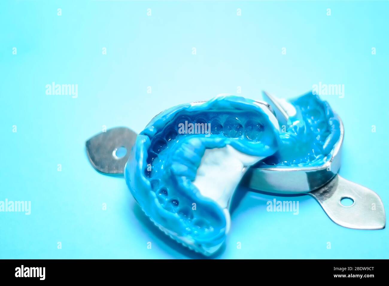 Two dental impressions on a blue background with copy space. Dental molds from the upper and lower jaws of silicone material. Stock Photo