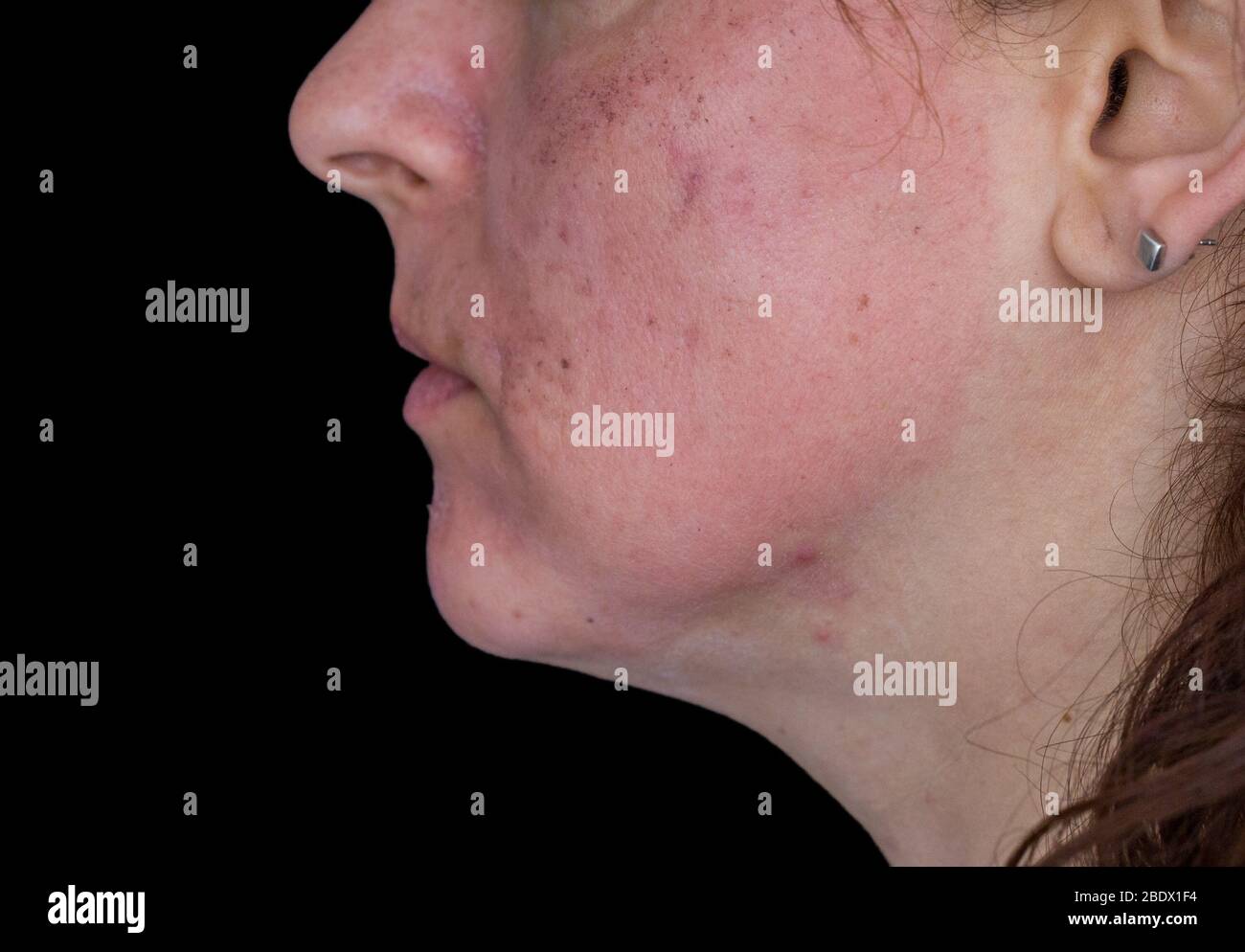 Black face mask woman peeling hi-res stock photography and images - Alamy