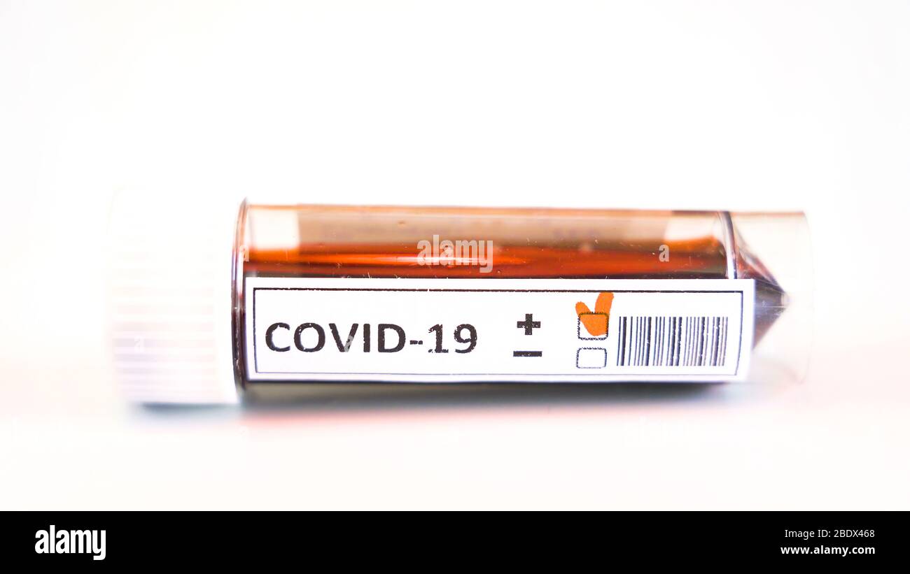 The white glass sample kit with blood inside for coronavirus testing ...